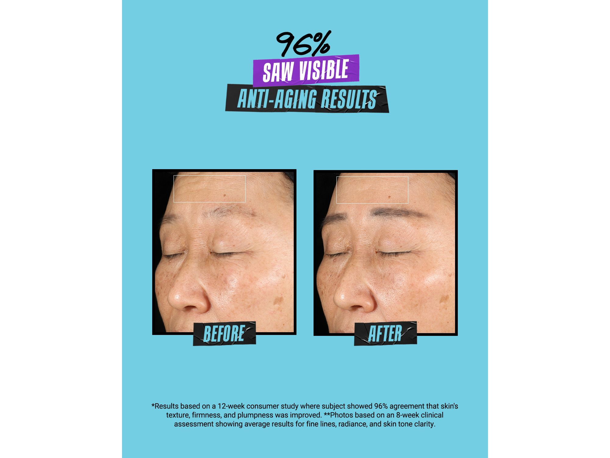 Super Multi Corrective Soft Cream — Image 5