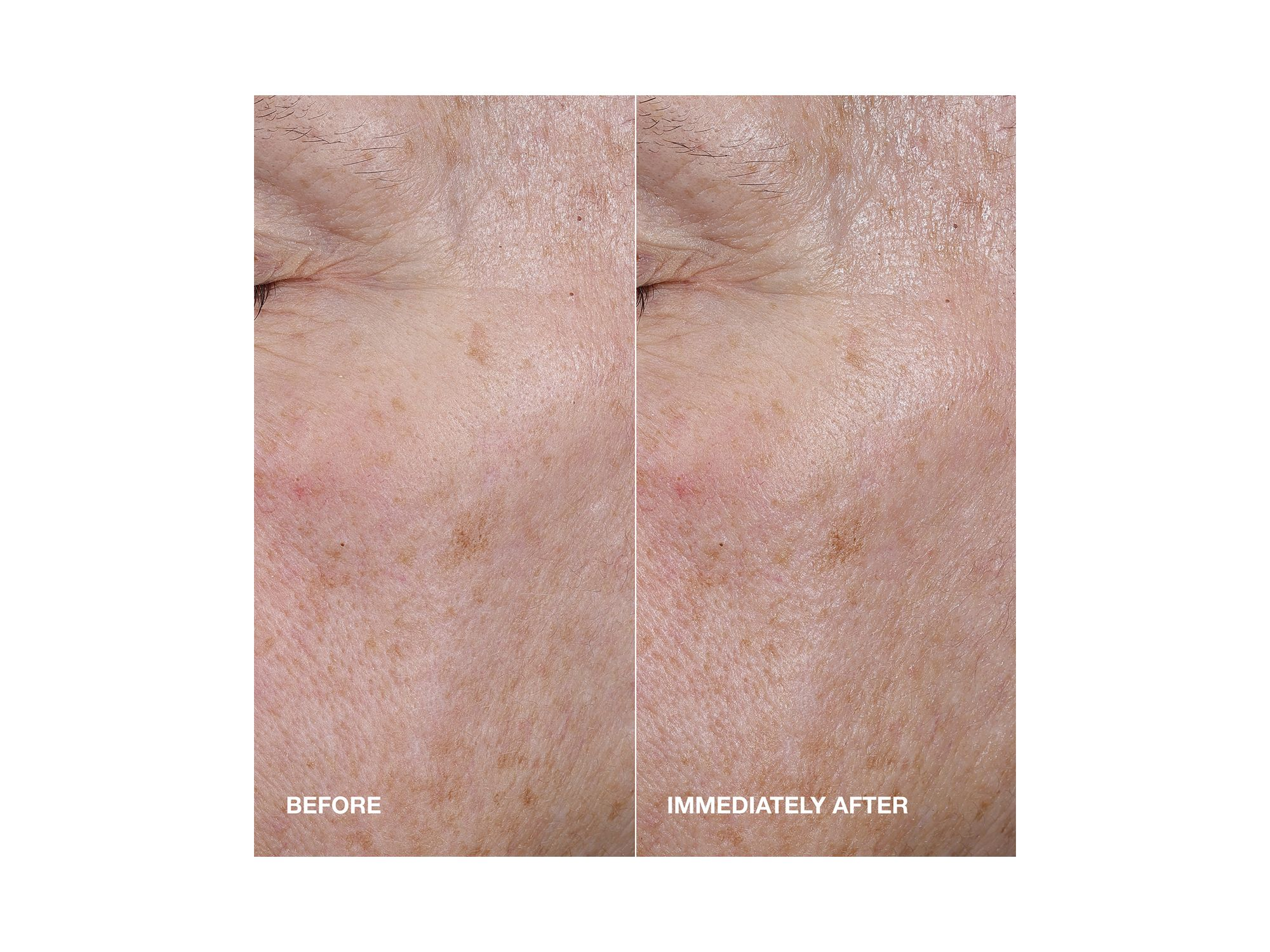Moisture Surge Active Glow Serum with Hyaluronic Acid — Image 4