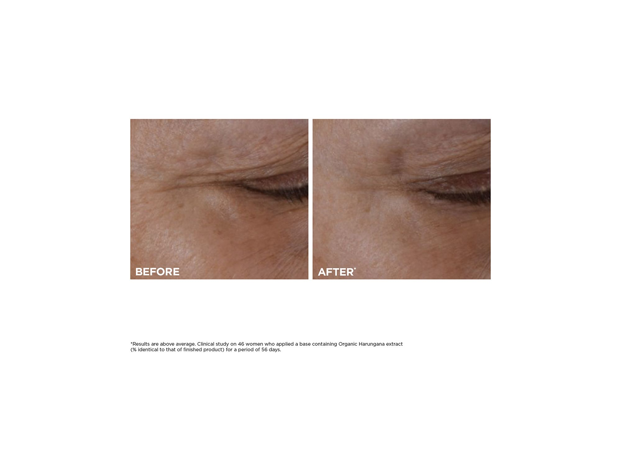 Total Eye Lift Eye Cream — Image 13