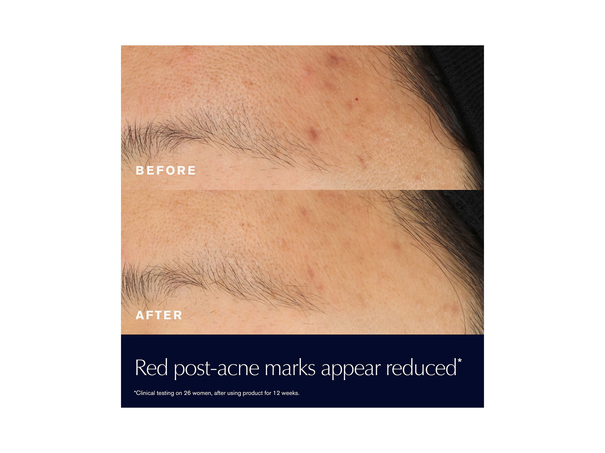 Advanced Night Repair Rescue Solution Serum with 15% Bifidus Ferment 0.68 oz. — Image 4