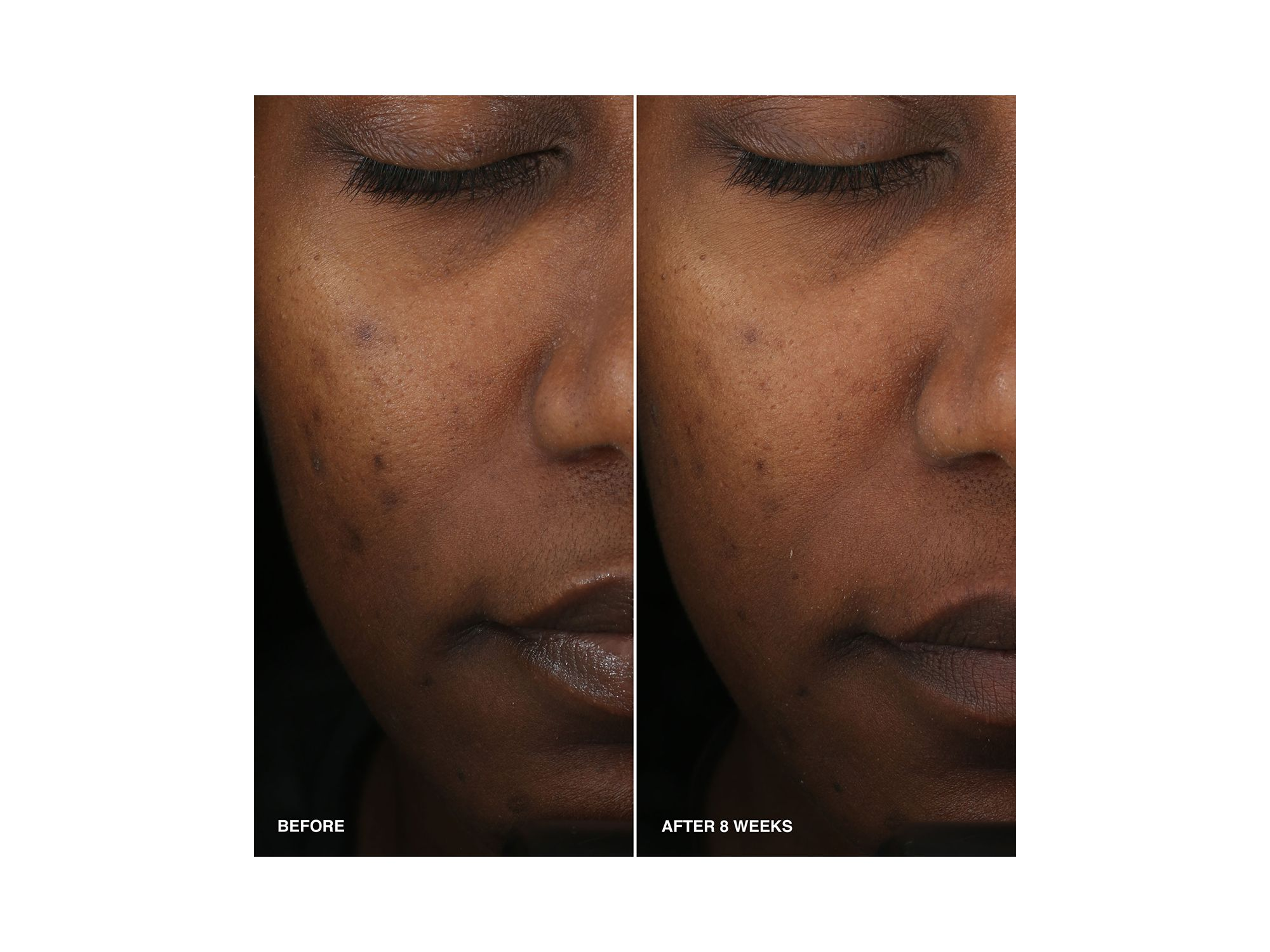 Vitamin Enriched Smoothing Serum with Niacinamide 1.01 oz. — Image 4