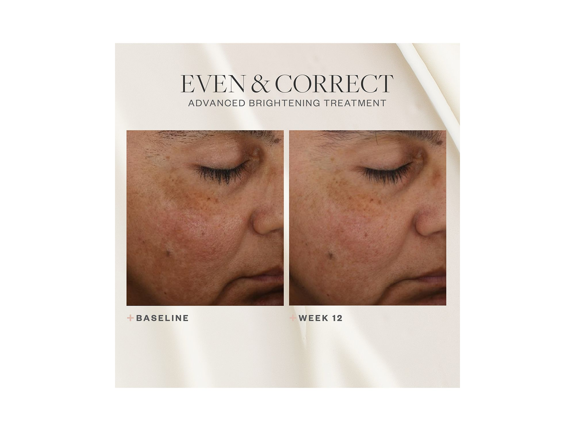 Even & Correct Advanced Brightening Treatment 2 oz. — Image 5