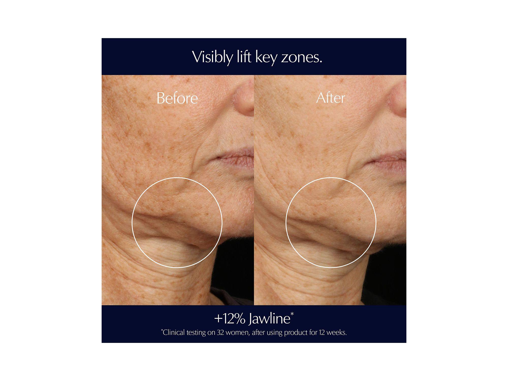 Perfectionist Pro Rapid Firm + Lift Serum Duo ($270 value) — Image 7