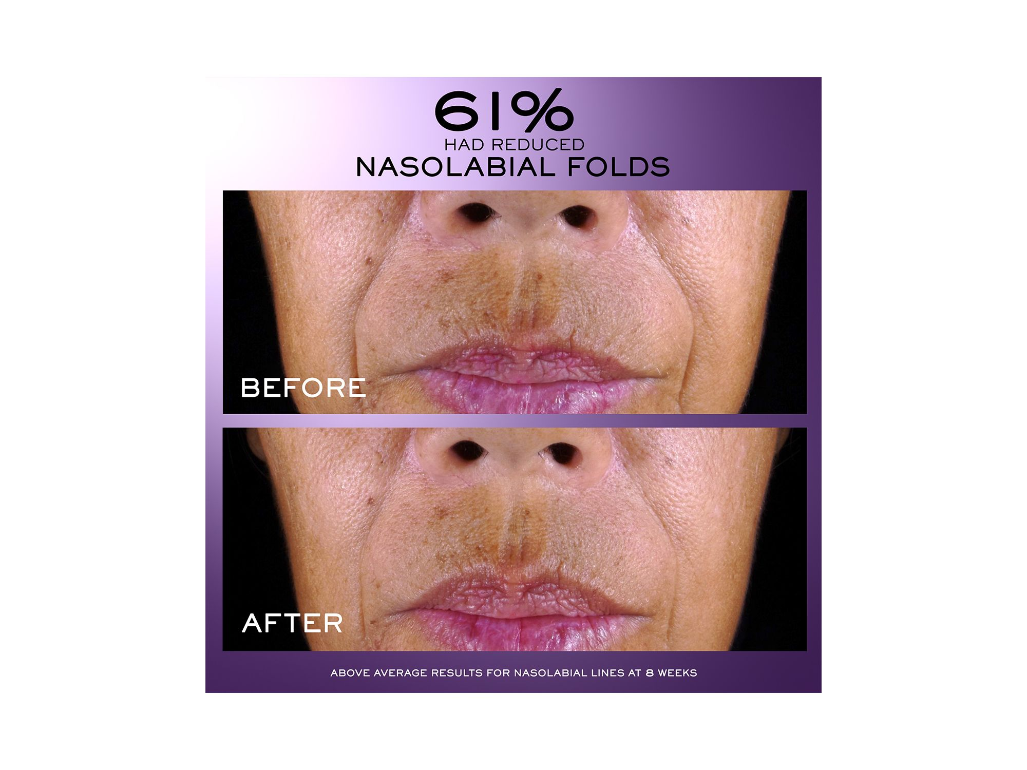 Rénergie C.R.x. Triple Serum Retinol — Image 3