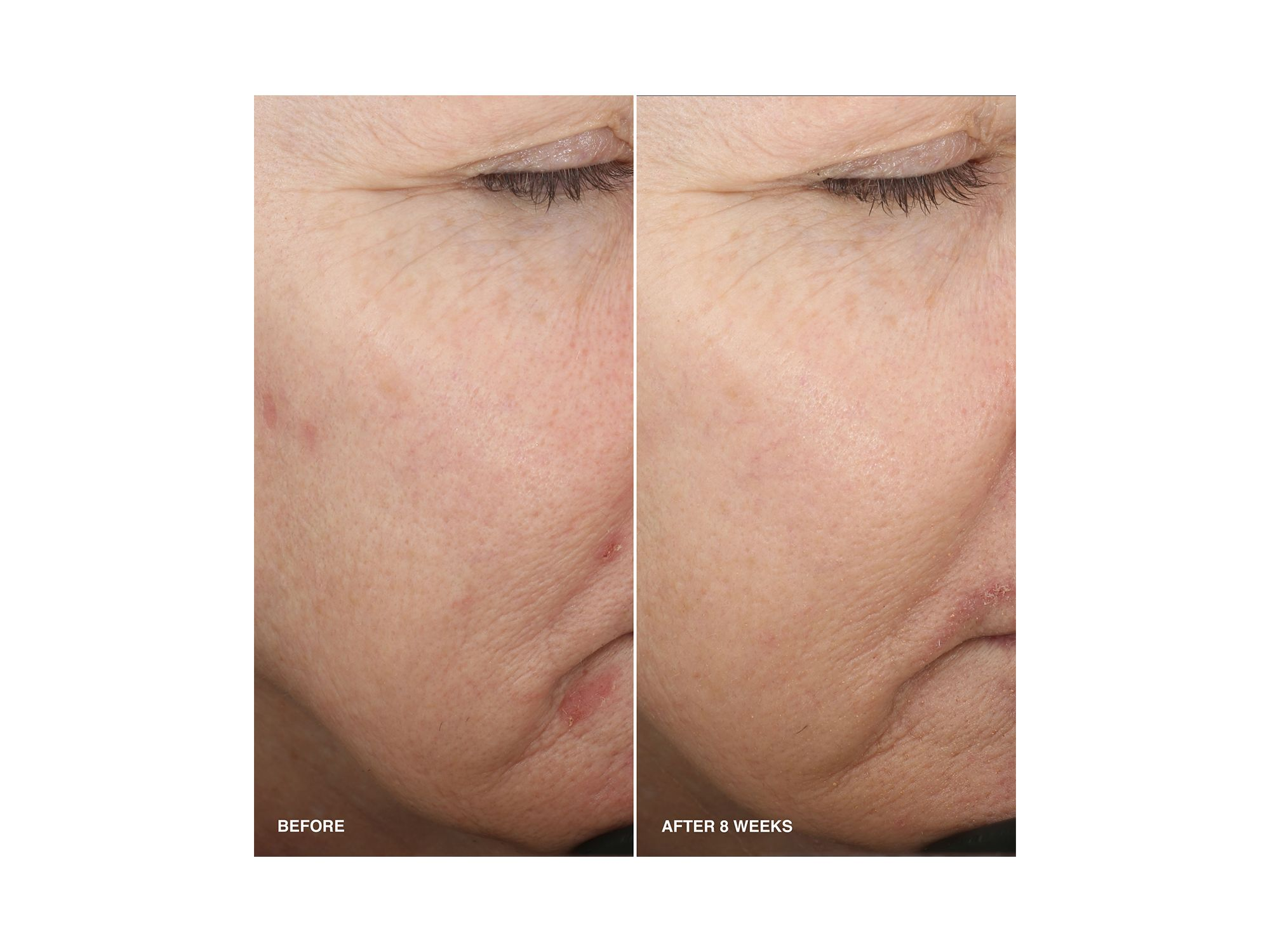 Vitamin Enriched Smoothing Serum with Niacinamide 1.01 oz. — Image 5