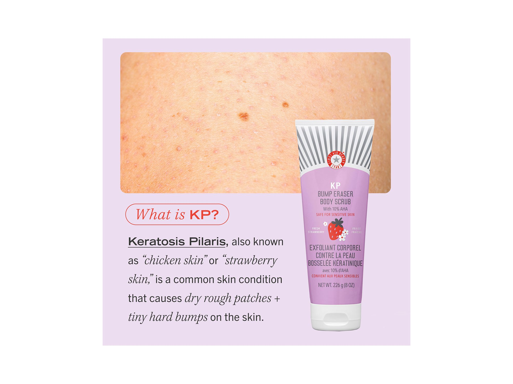 KP Bump Eraser Body Scrub with 10% AHA Body Exfoliant for Keratosis Pilaris - Strawberry — Image 7