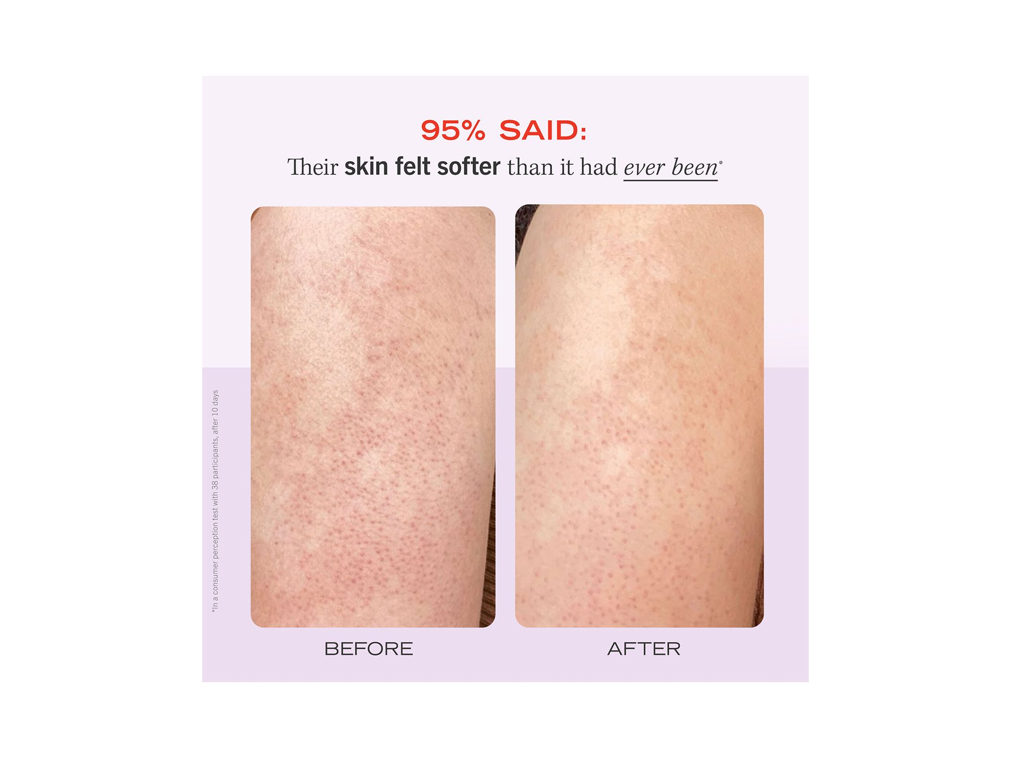 KP Bump Eraser Body Scrub with 10% AHA Body Exfoliant for Keratosis Pilaris - Strawberry — Image 9