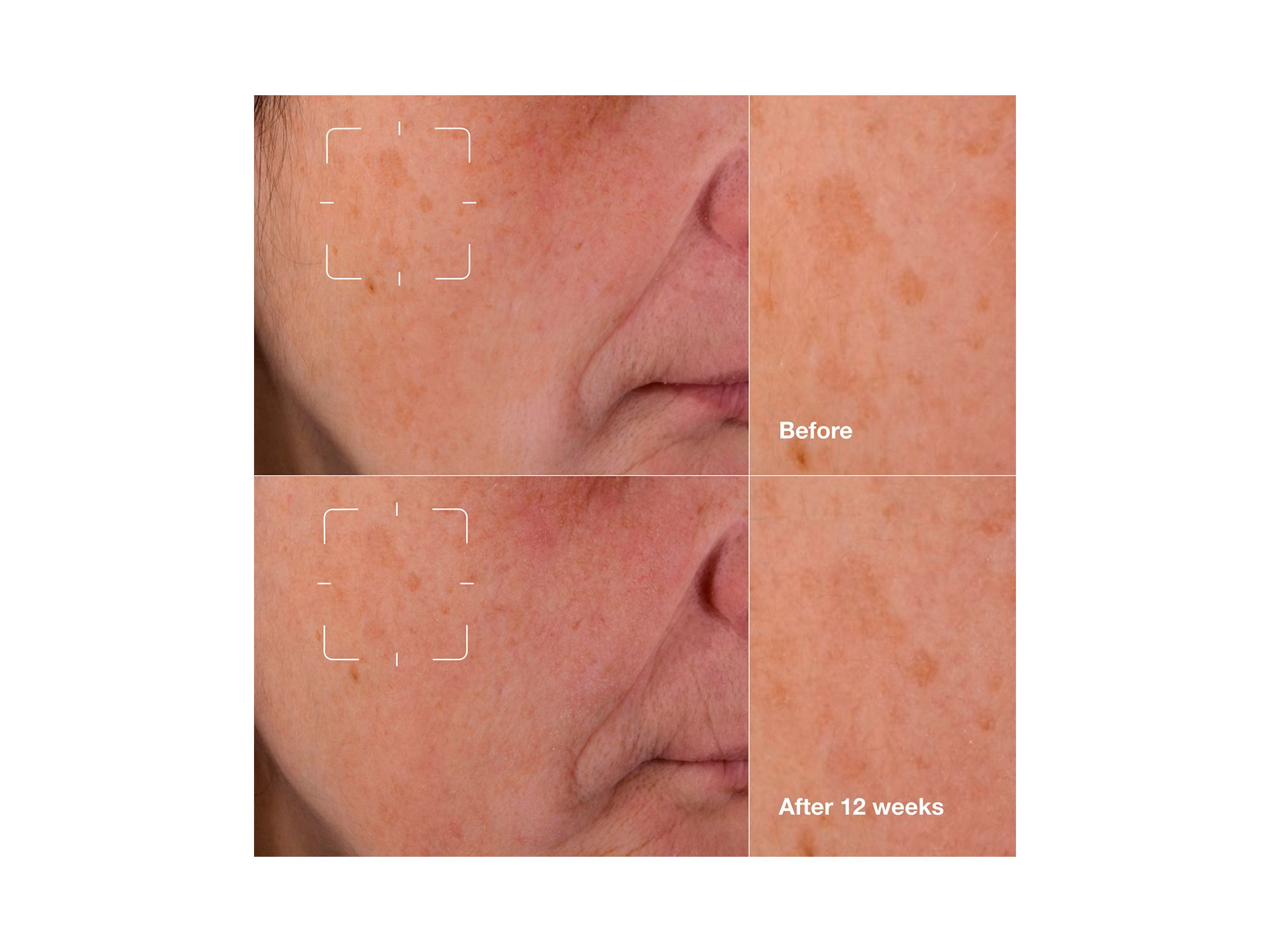 Even Better Clinical Dark Spot Clearing Serum with Vitamin C — Image 4