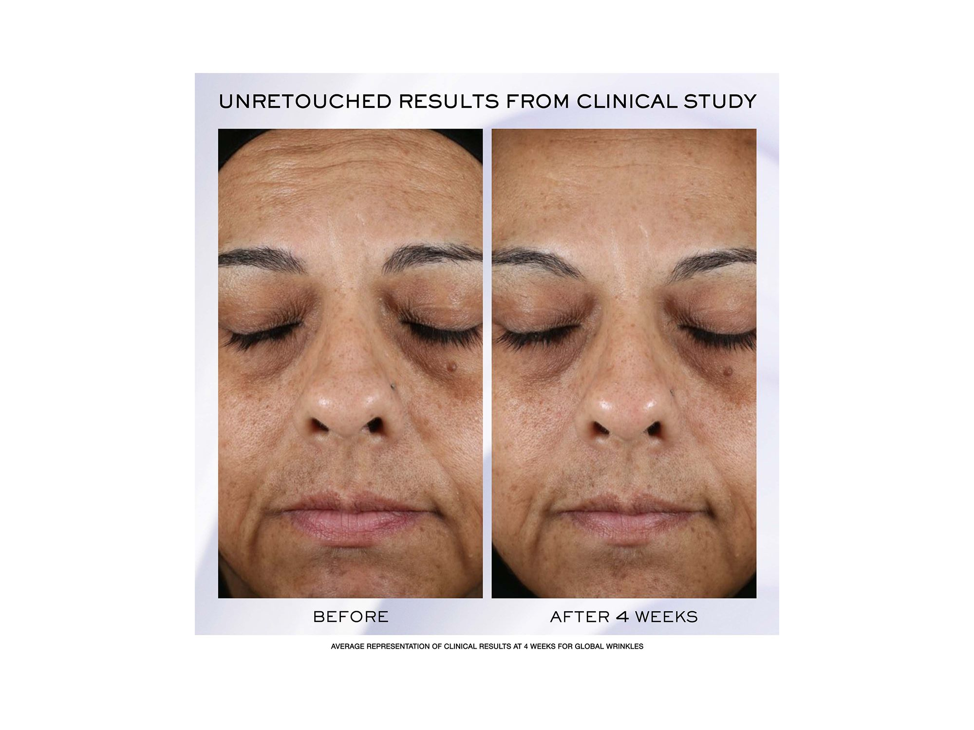 Rénergie H.P.N. 300-Peptide Anti-Aging Cream — Image 3