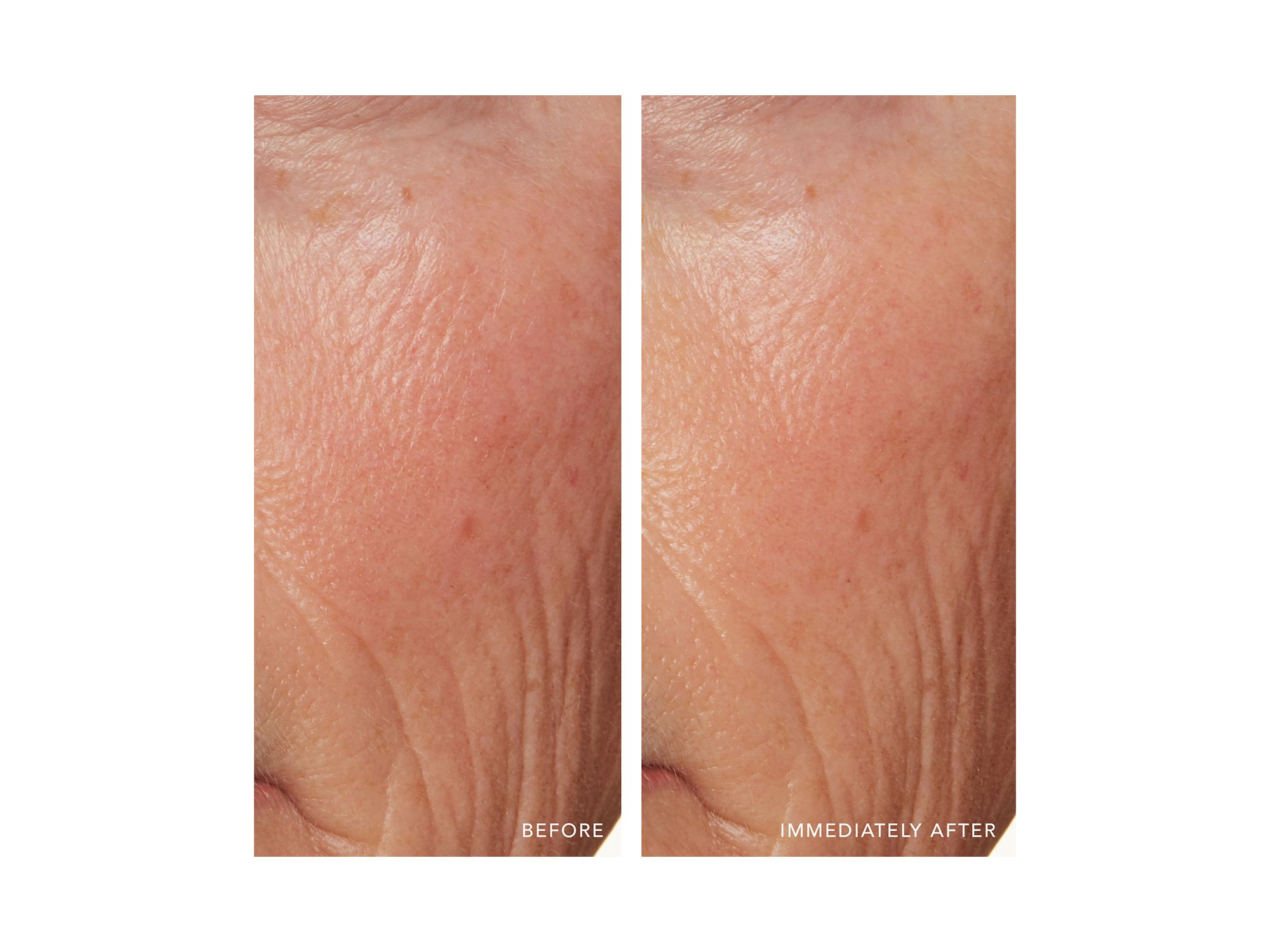 Redness Relief Intense with Manuka Honey 1.7 oz. — Image 4