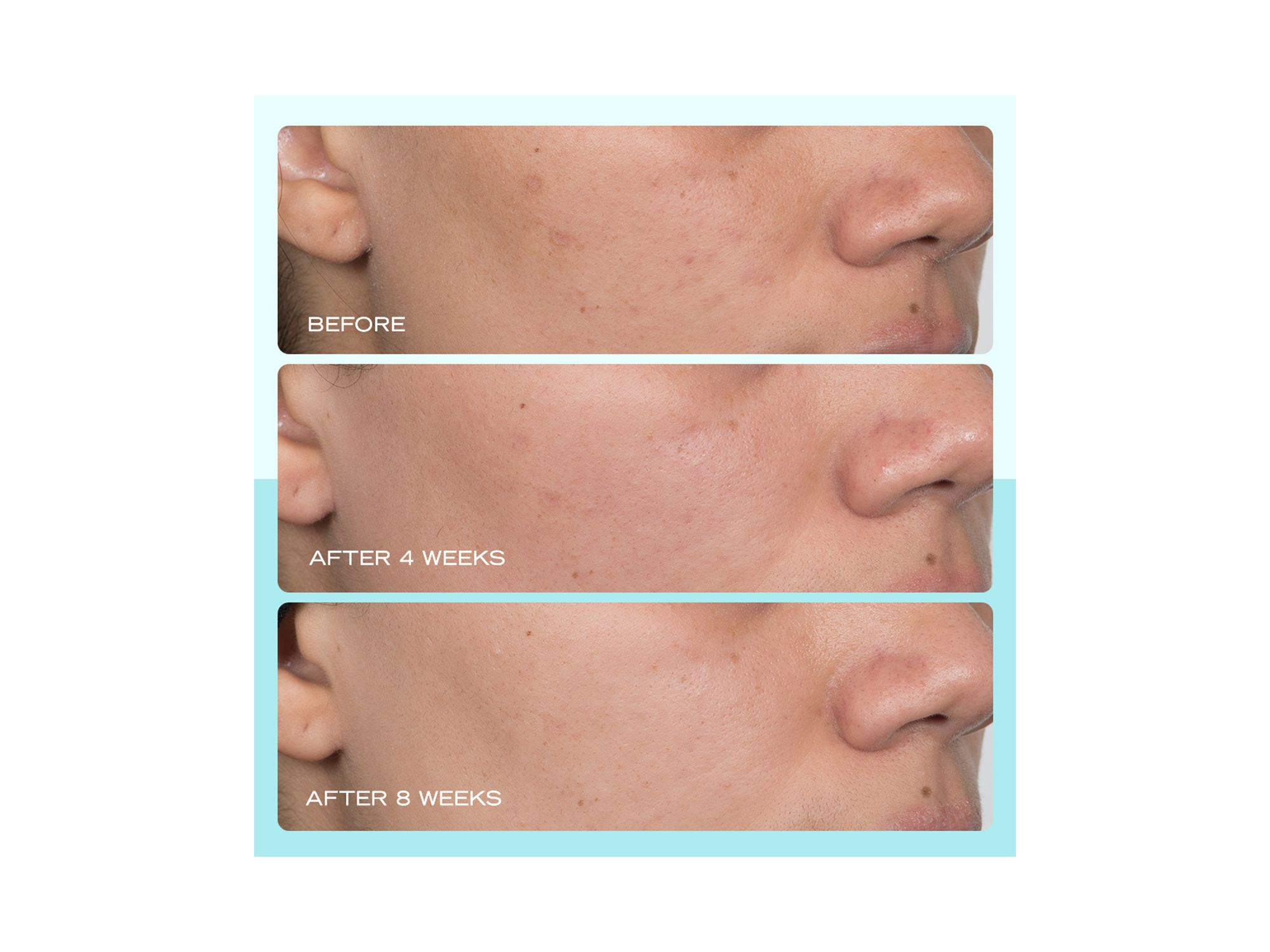 Dark Spot Serum with Niacinamide 1 oz. — Image 4