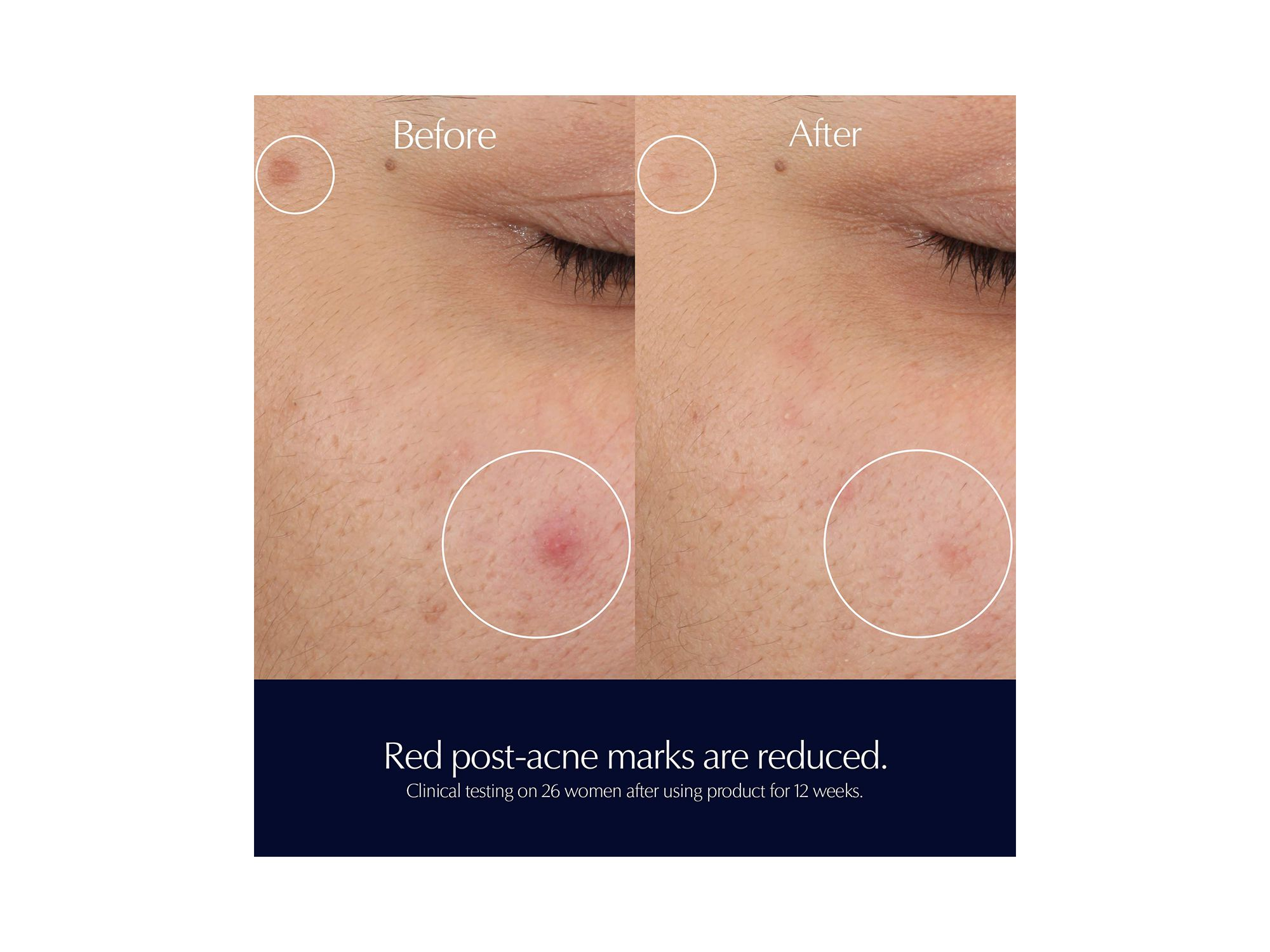 Advanced Night Repair Rescue Solution Serum with 15% Bifidus Ferment 0.68 oz. — Image 6