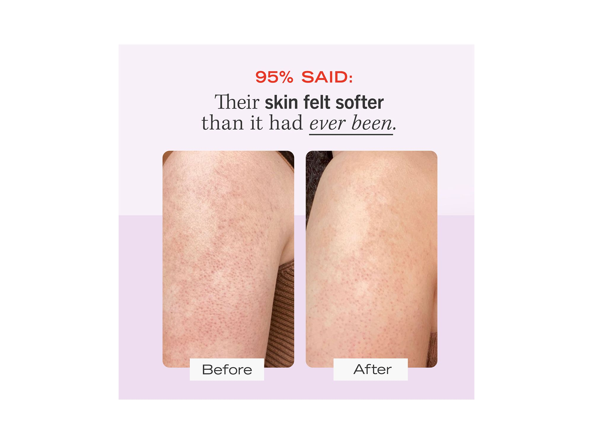 KP Bump Eraser Body Scrub with 10% AHA - Body Exfoliant for Keratosis Pilaris — Image 6