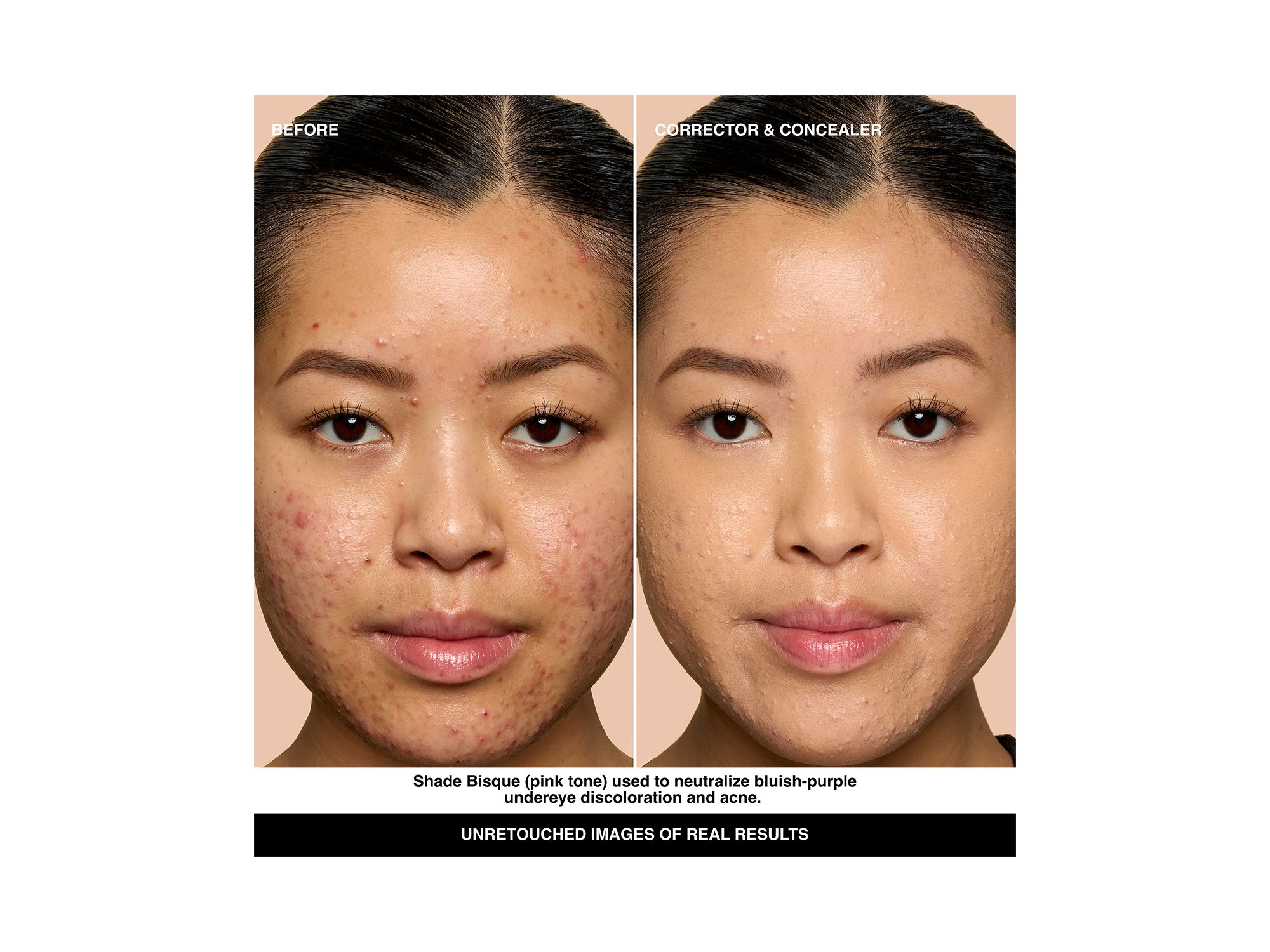Skin Corrector Stick — Image 5