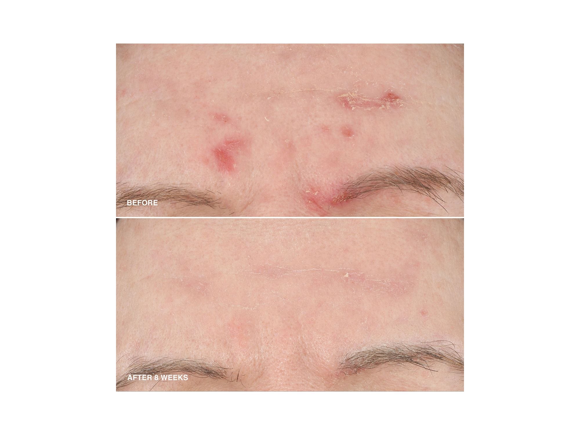 Vitamin Enriched Smoothing Serum with Niacinamide 1.01 oz. — Image 3