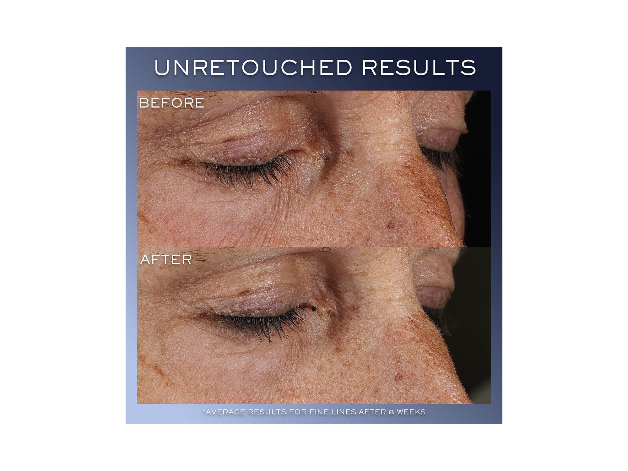 Advanced Génifique Yeux Eye Cream — Image 3
