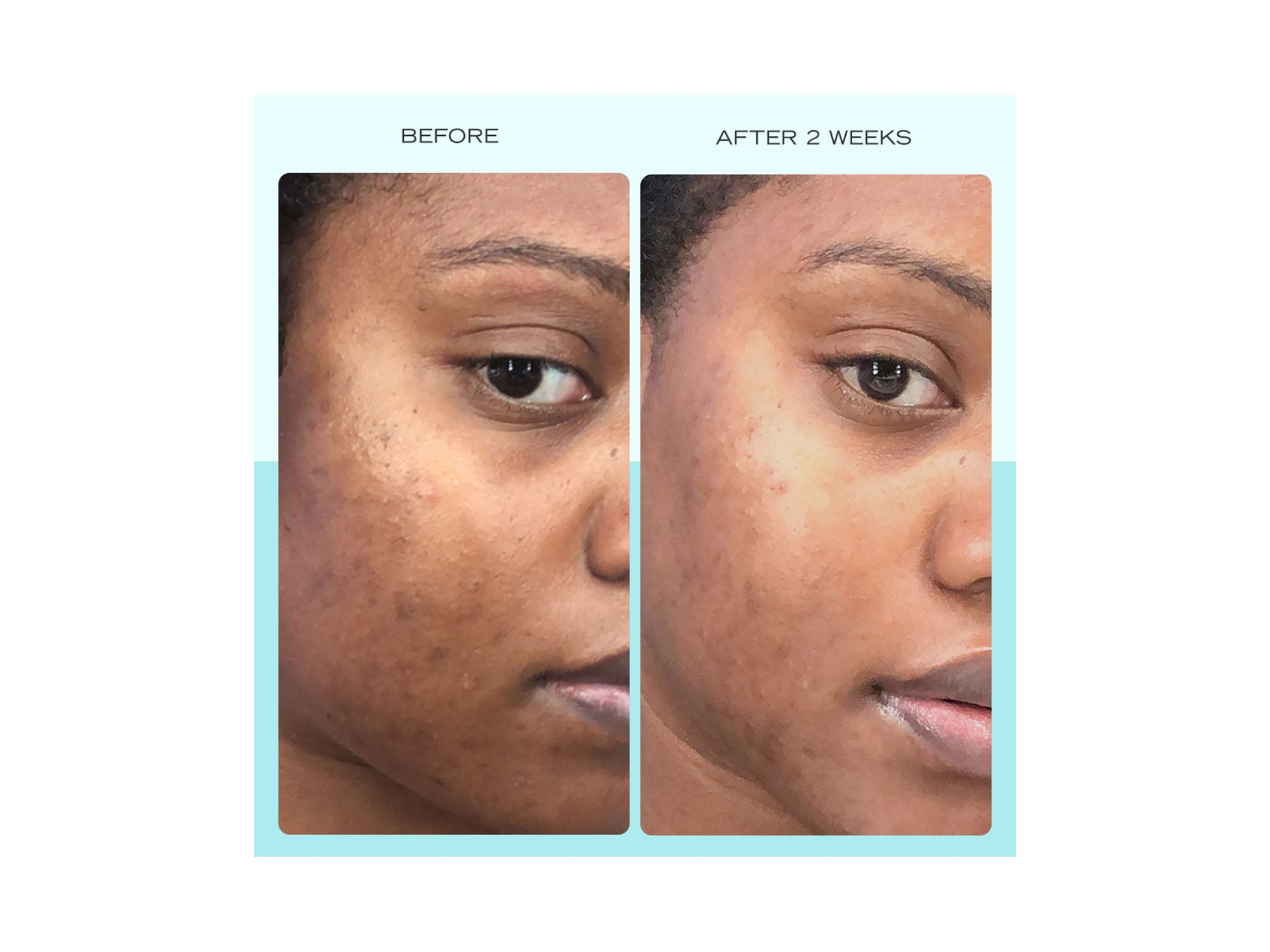 Dark Spot Serum with Niacinamide 1 oz. — Image 9