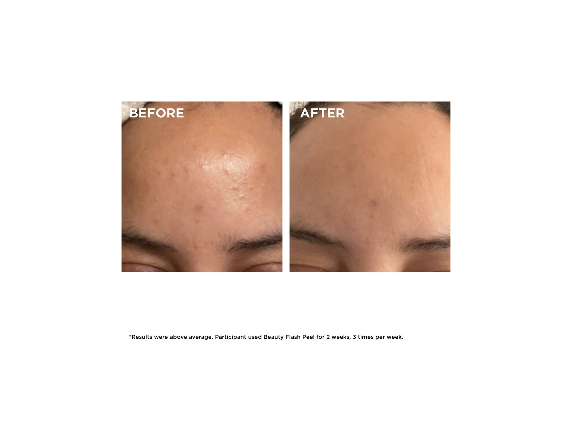 Beauty Flash Peel with BHA & AHA 1.7 oz. — Image 6