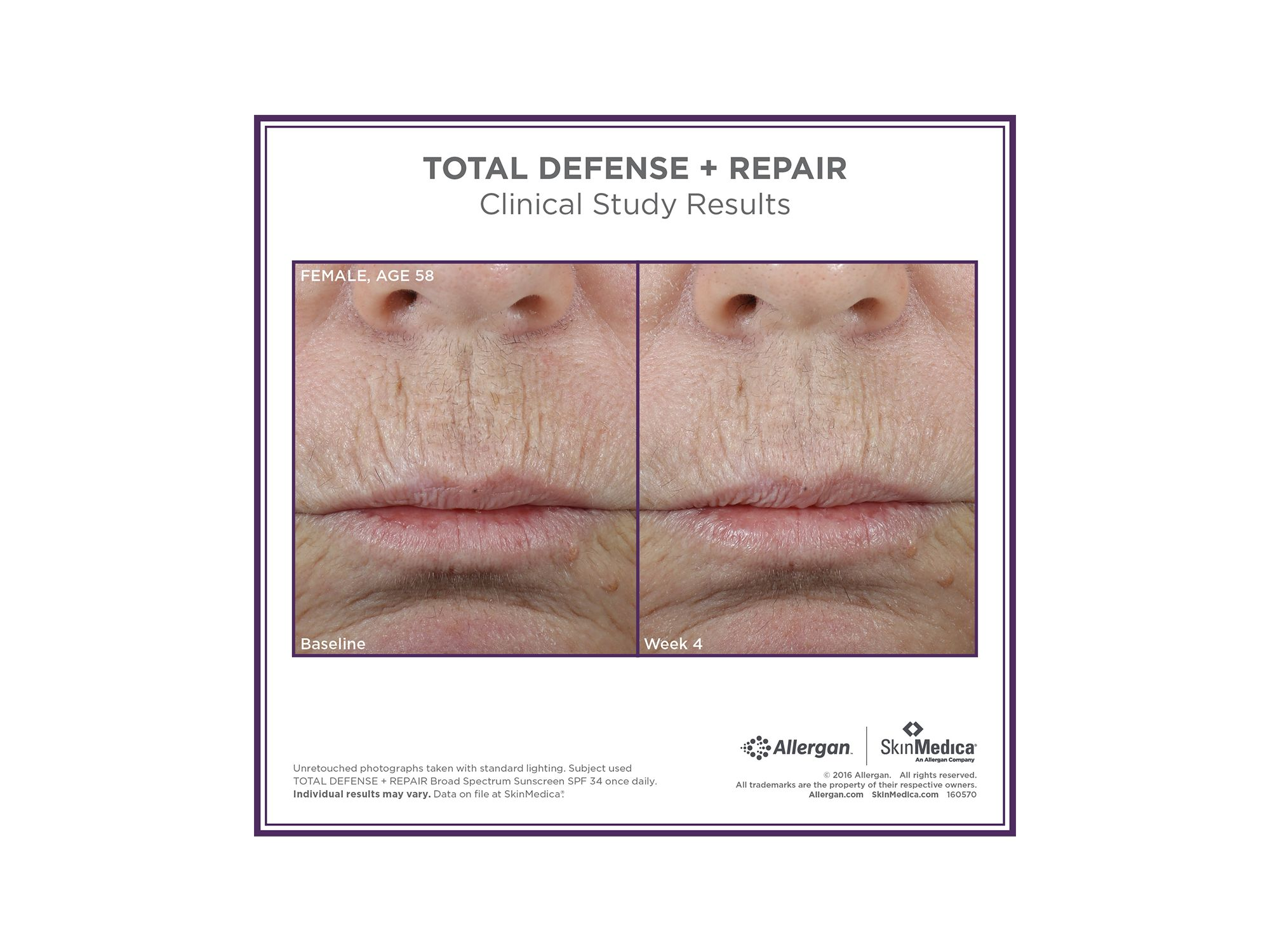 Total Defense + Repair SPF 34 Sunscreen 2.3 oz. — Image 4