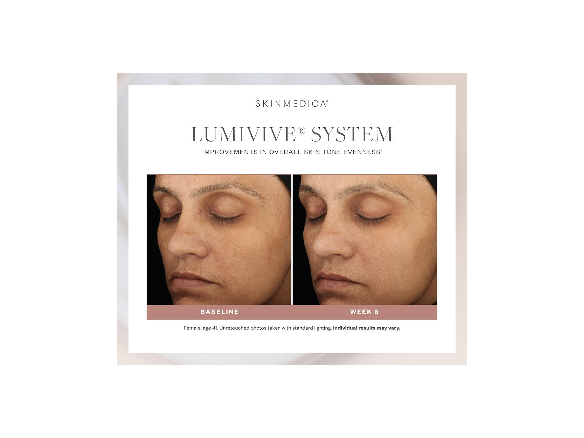 Lumivive System — Image 6