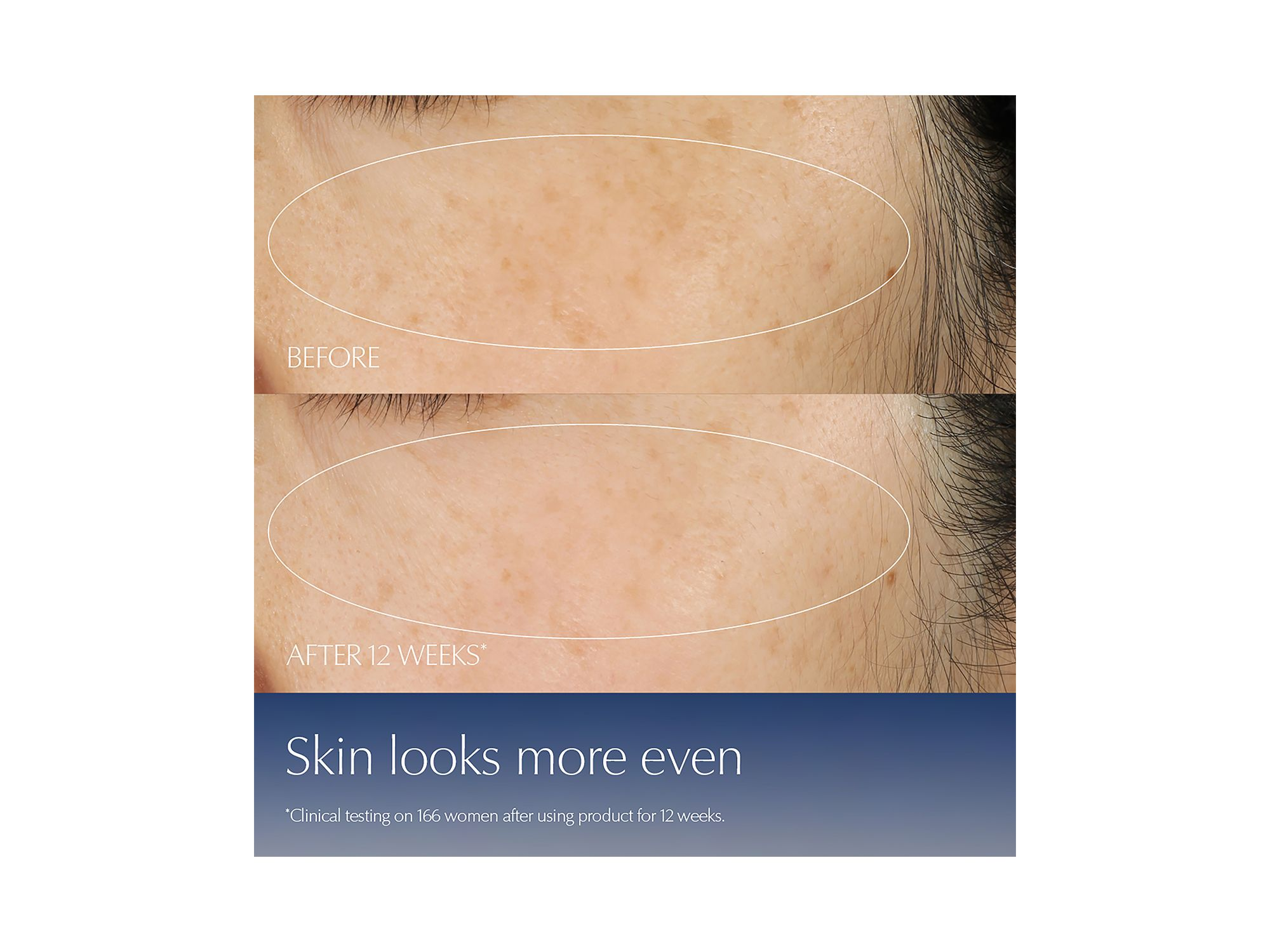 Advanced Night Repair Synchronized Multi-Recovery Complex Serum Duo — Image 4