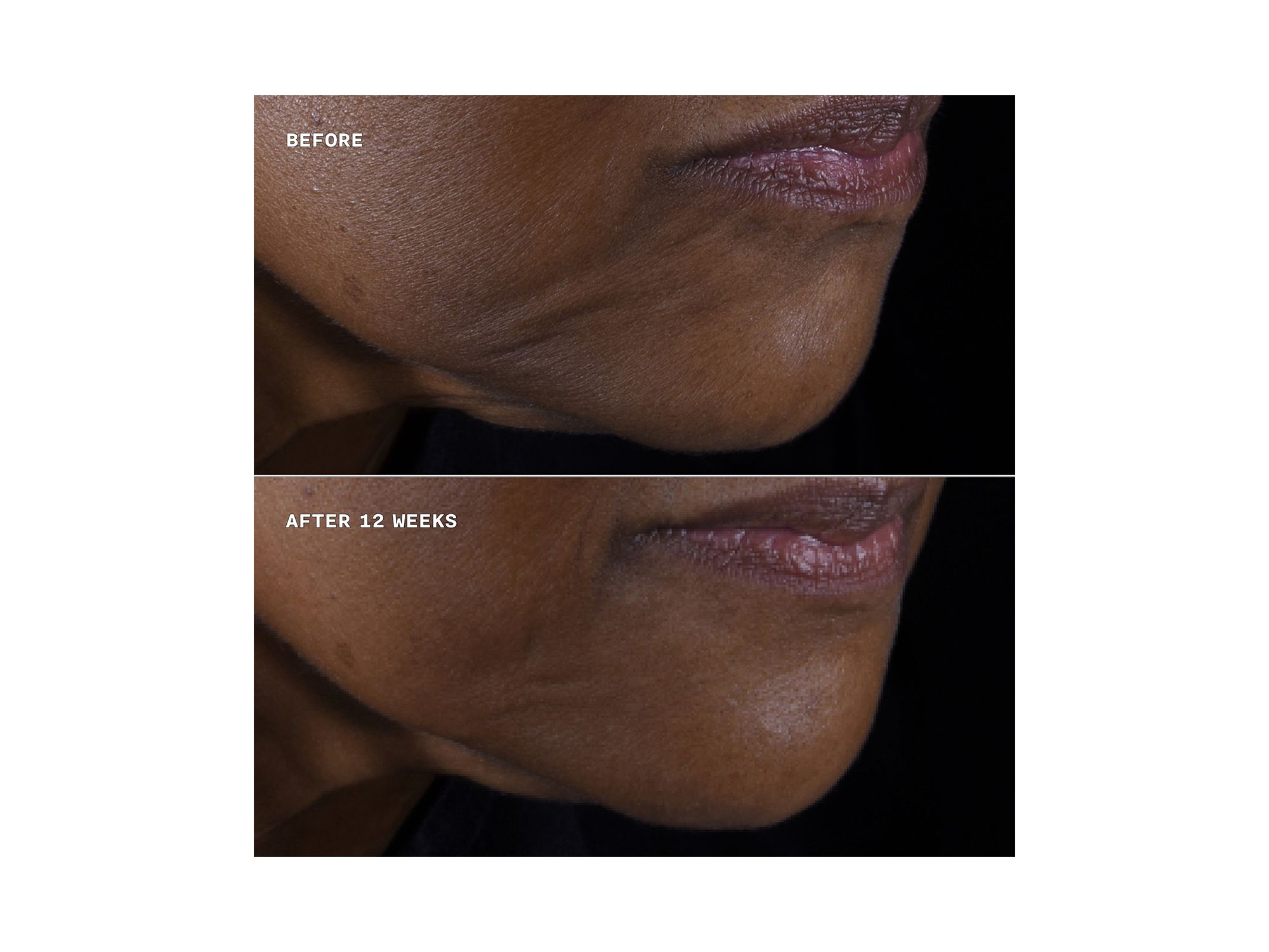 Smart Clinical Repair Lifting Face + Neck Cream — Image 4