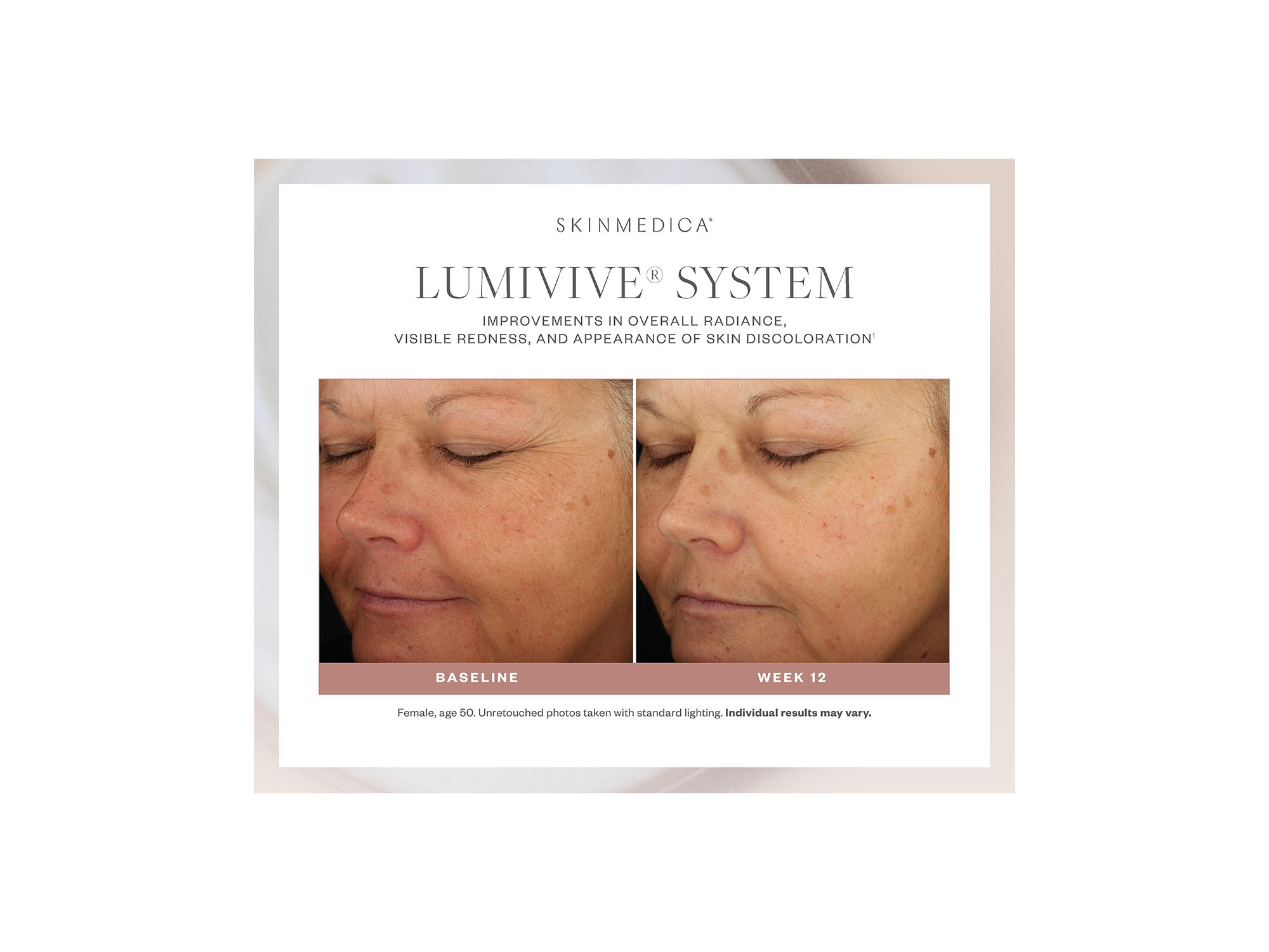 Lumivive System — Image 5