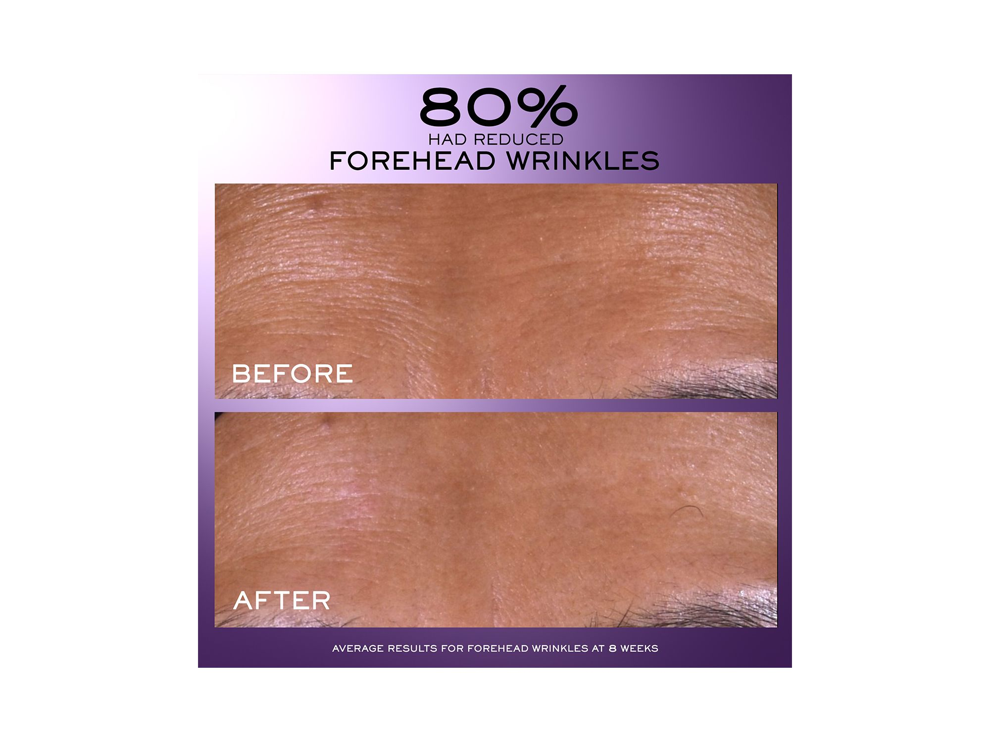 Rénergie C.R.x. Triple Serum Retinol — Image 9