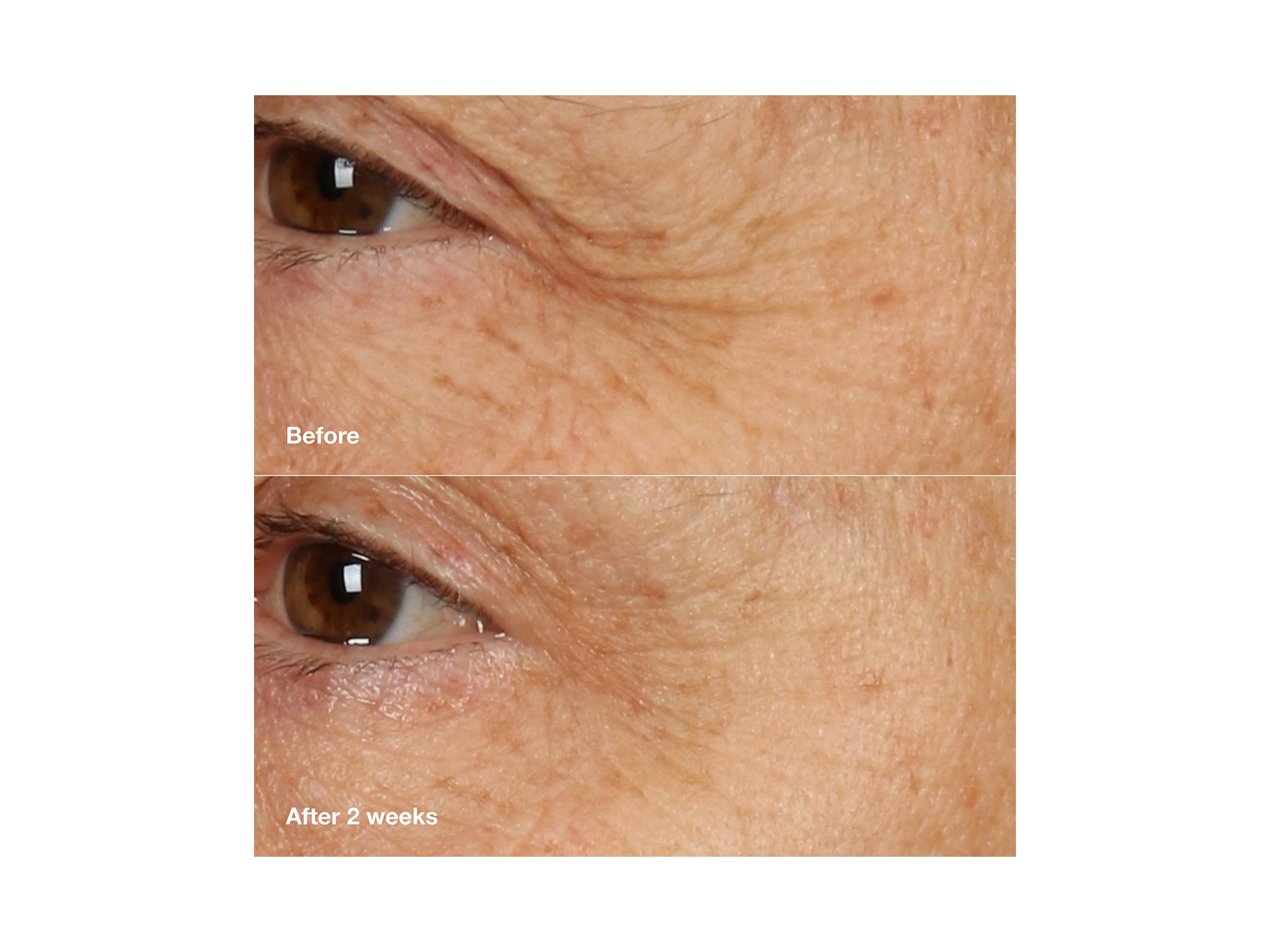Smart Clinical Repair Overnight Recovery Cream + Mask 1.7 oz. — Image 3