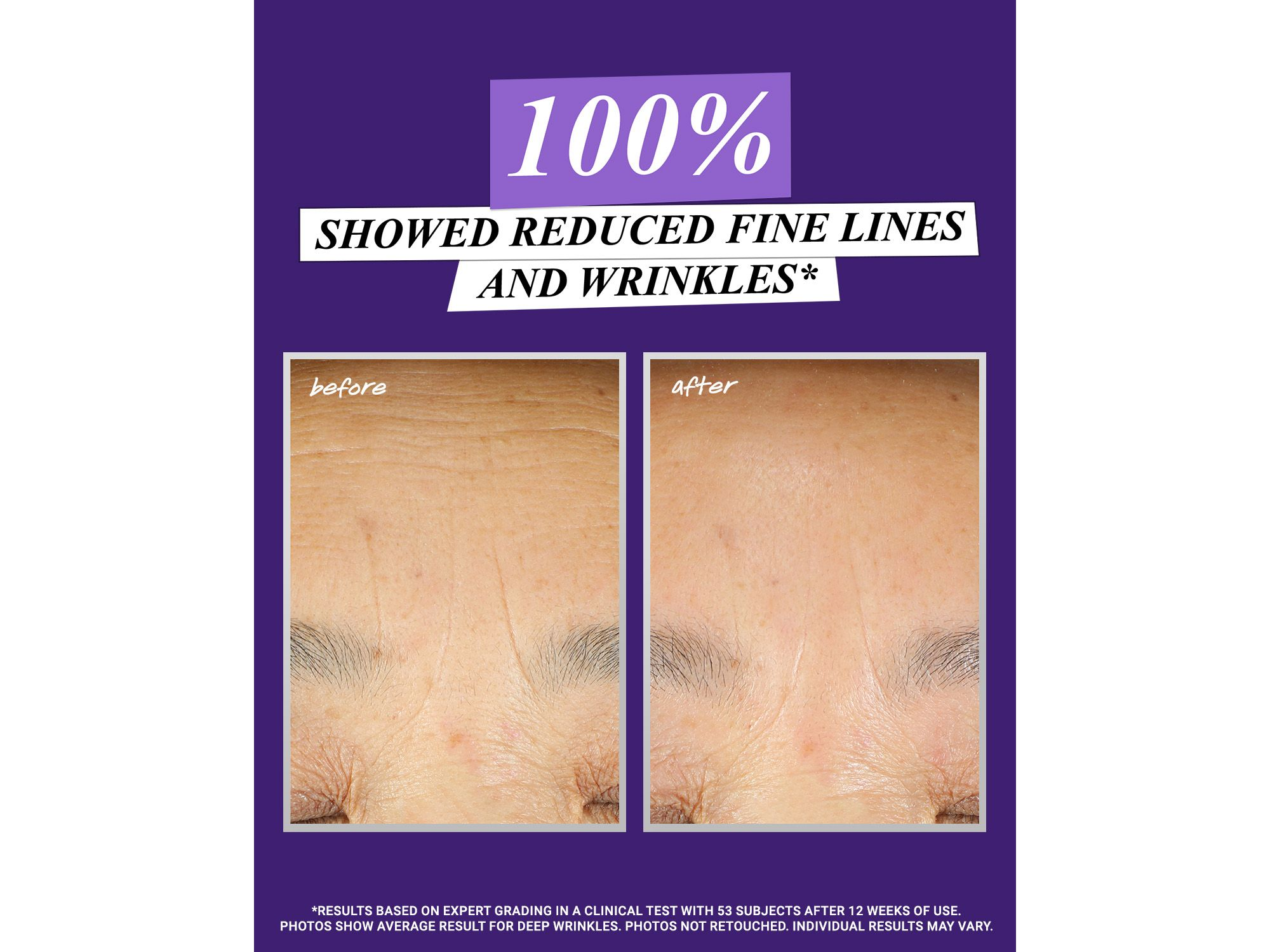 Retinol Skin-Renewing Daily Micro-Dose Serum — Image 6