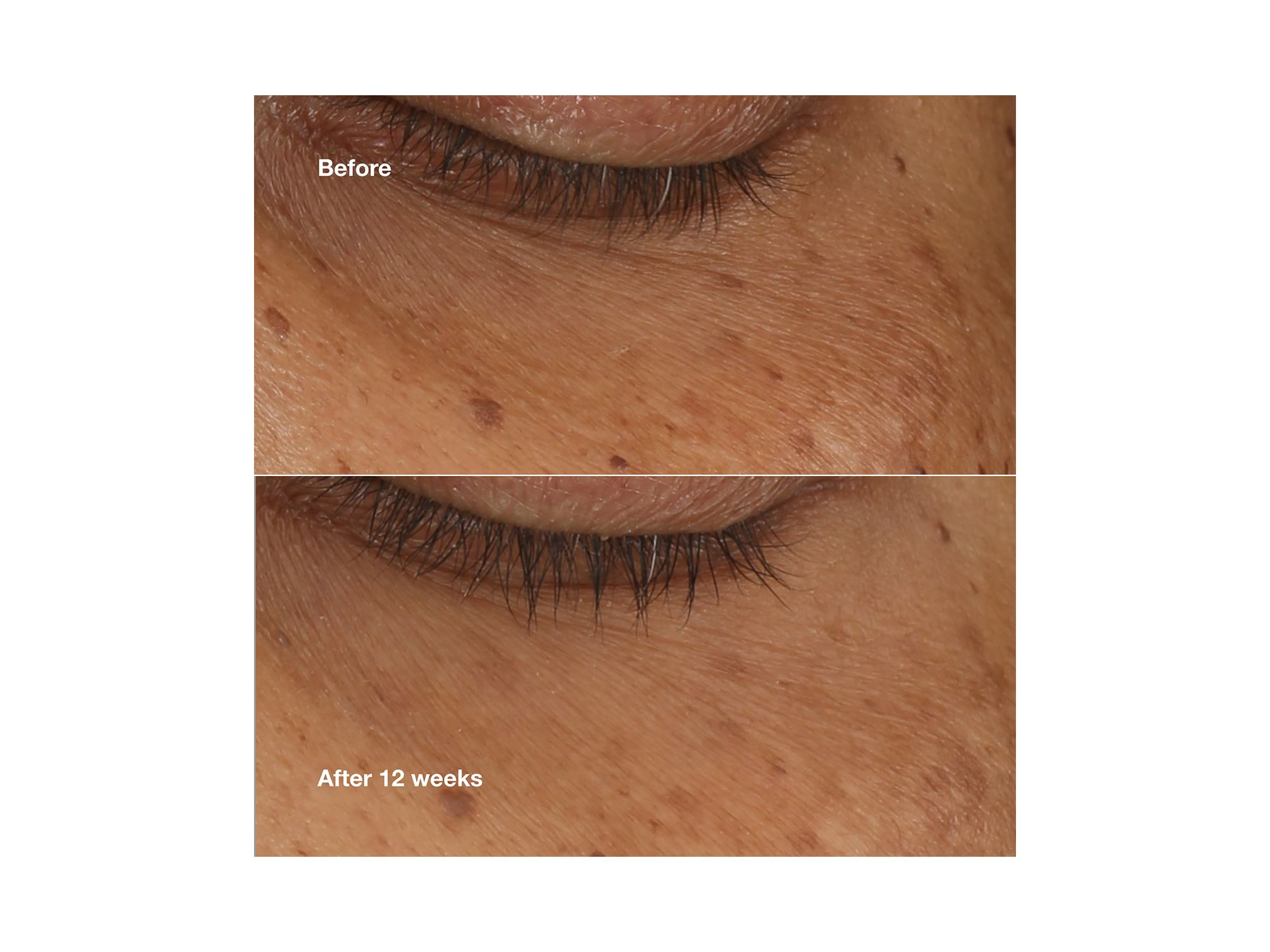All About Eyes Brightening Serum Concentrate 0.34 oz. — Image 3