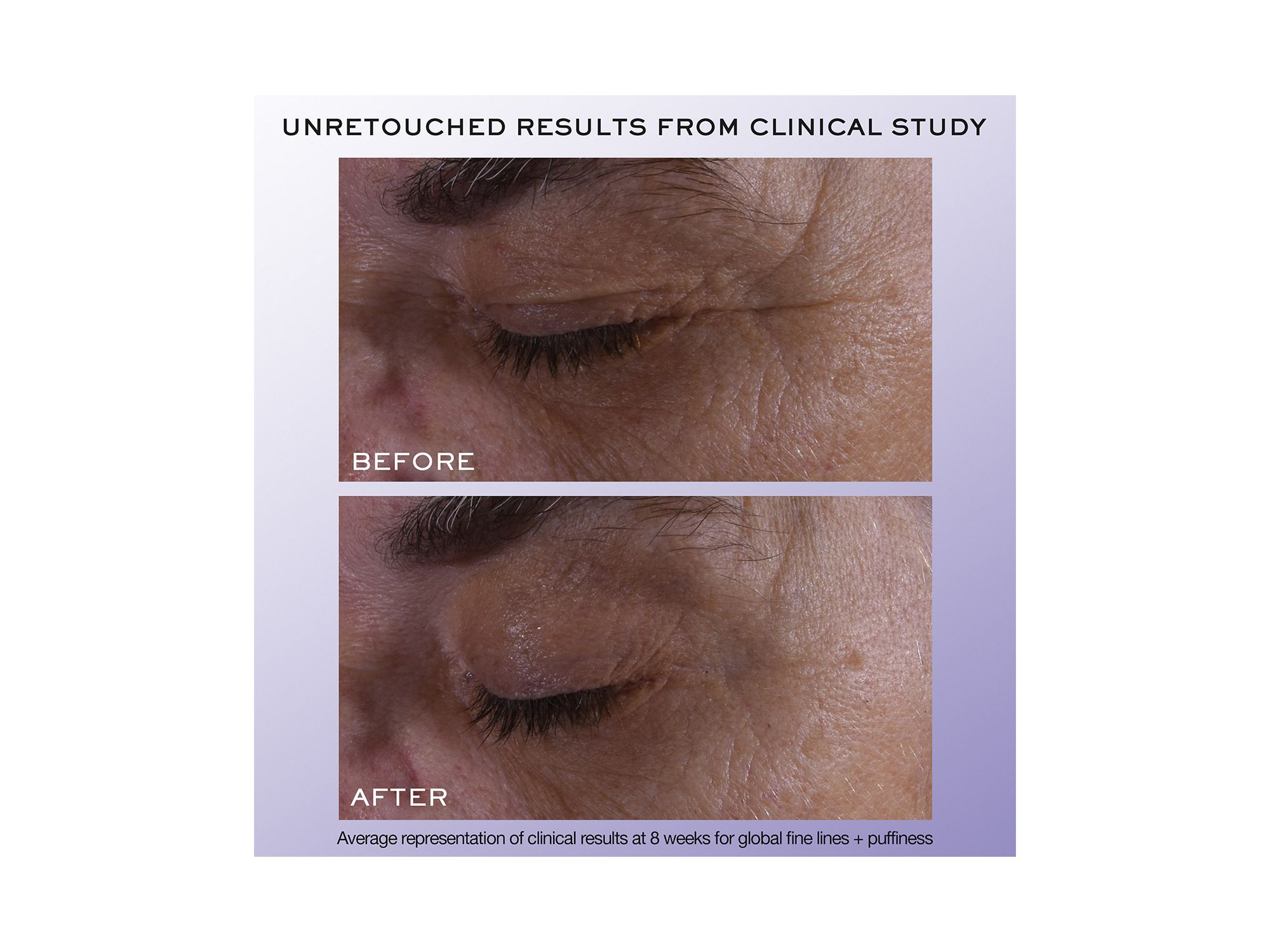 Rénergie H.C.F. Triple Serum Eye 0.67 oz. — Image 4
