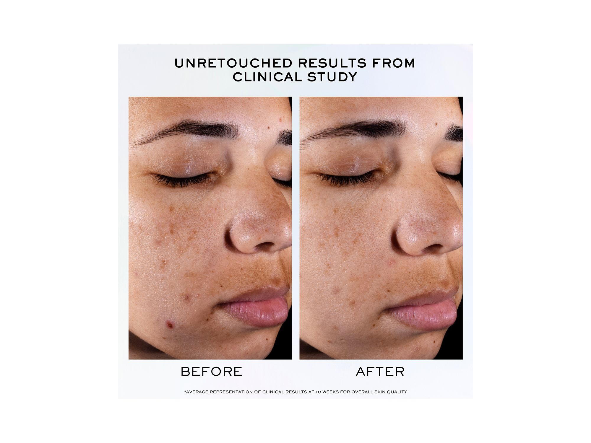 Clarifique Pro Solution Brightening & Dark Spot Reducing Serum — Image 3