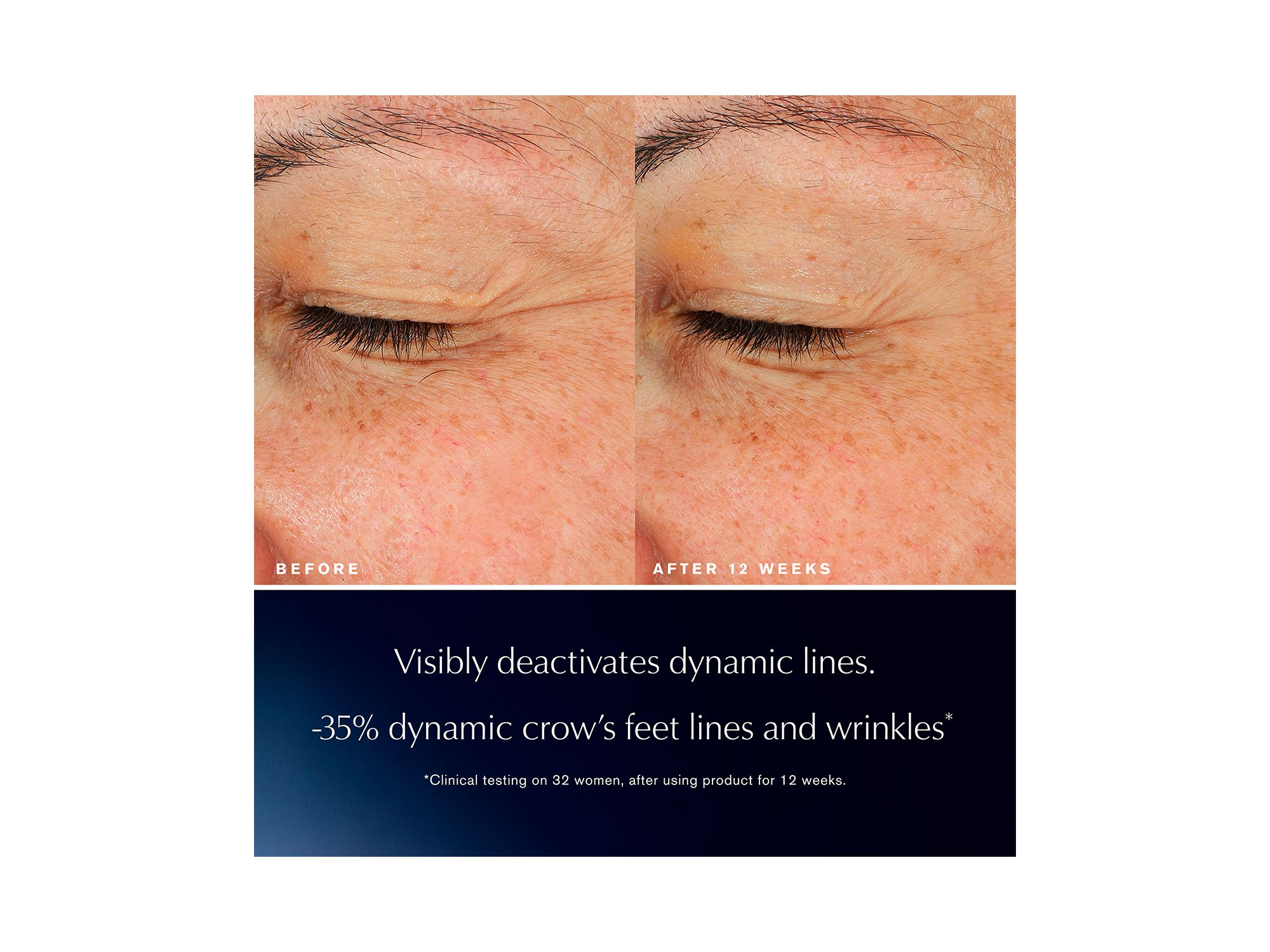 Advanced Night Repair Eye Lift + Sculpt Eye Cream 0.5 oz. — Image 3