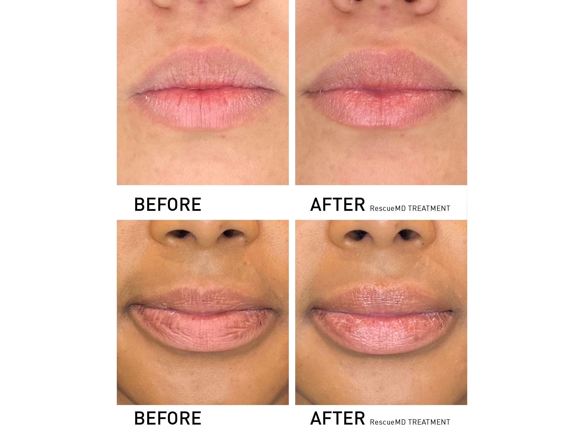 Restorative Lip Treatment 0.4 oz. — Image 3