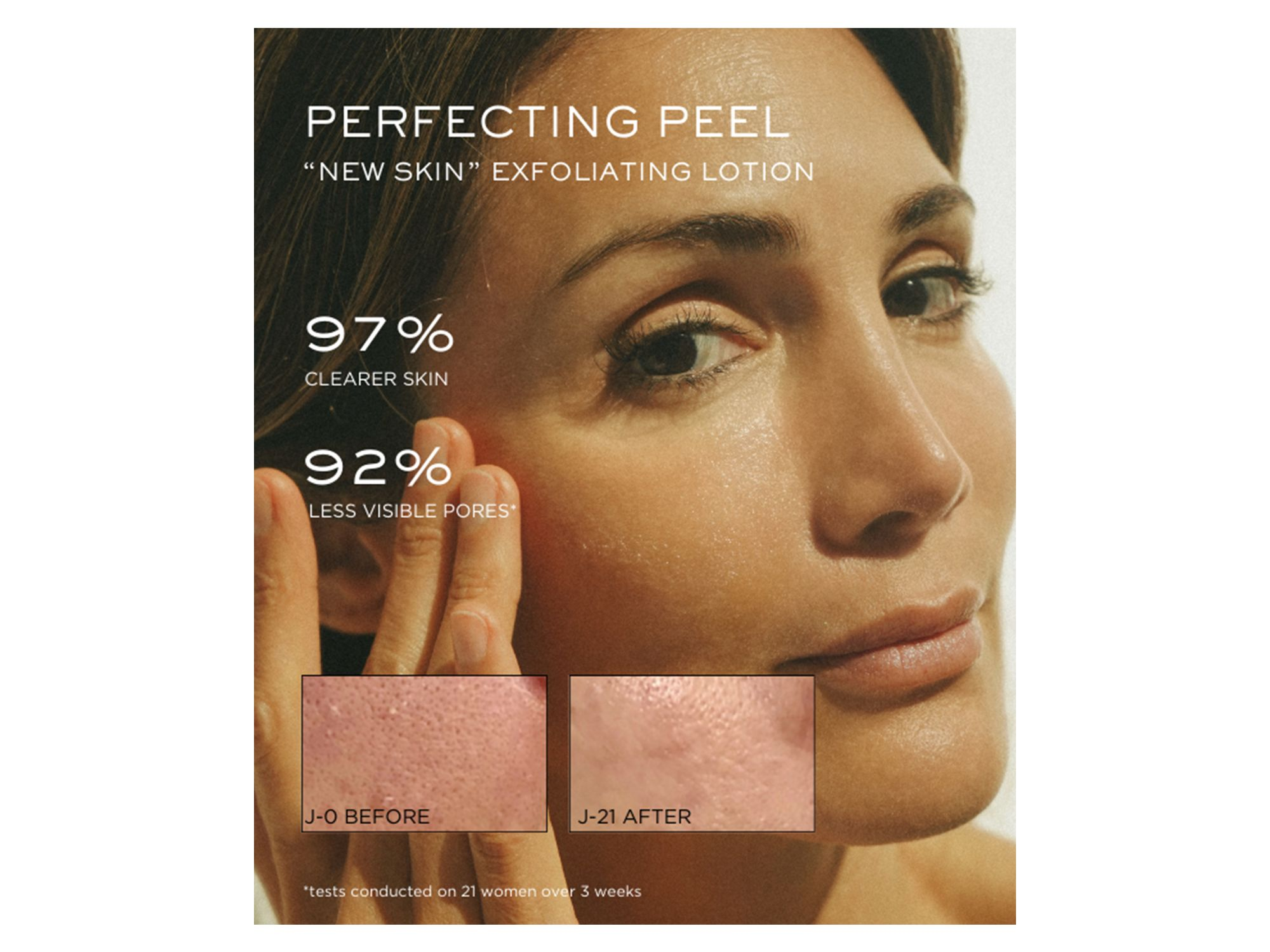 Perfecting Peel — Image 3
