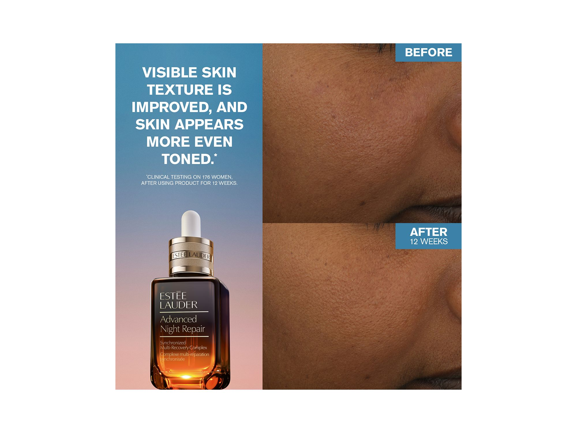 Nightly Renewal Skincare Set ($197 value) — Image 11