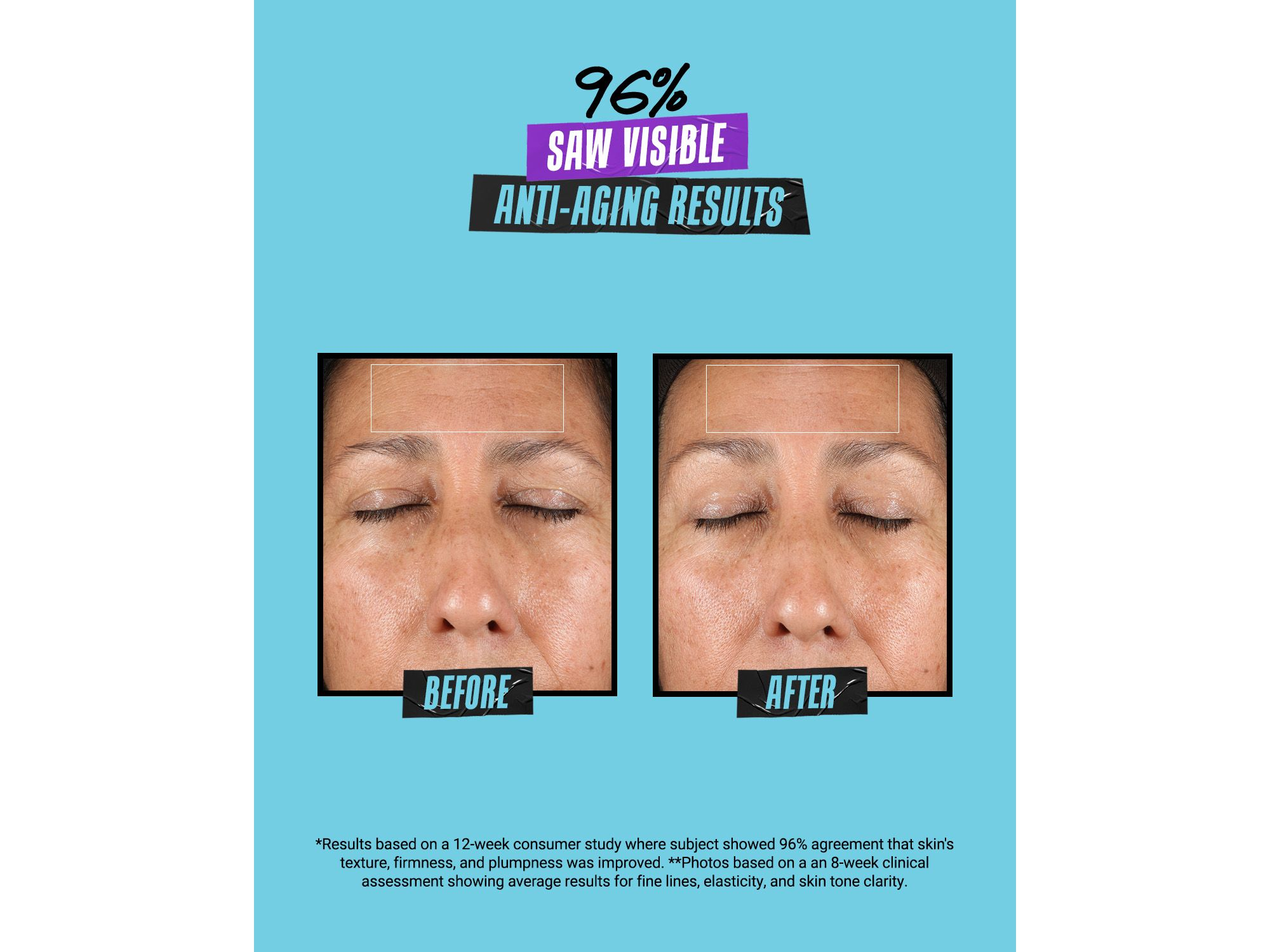 Super Multi Corrective Soft Cream — Image 4