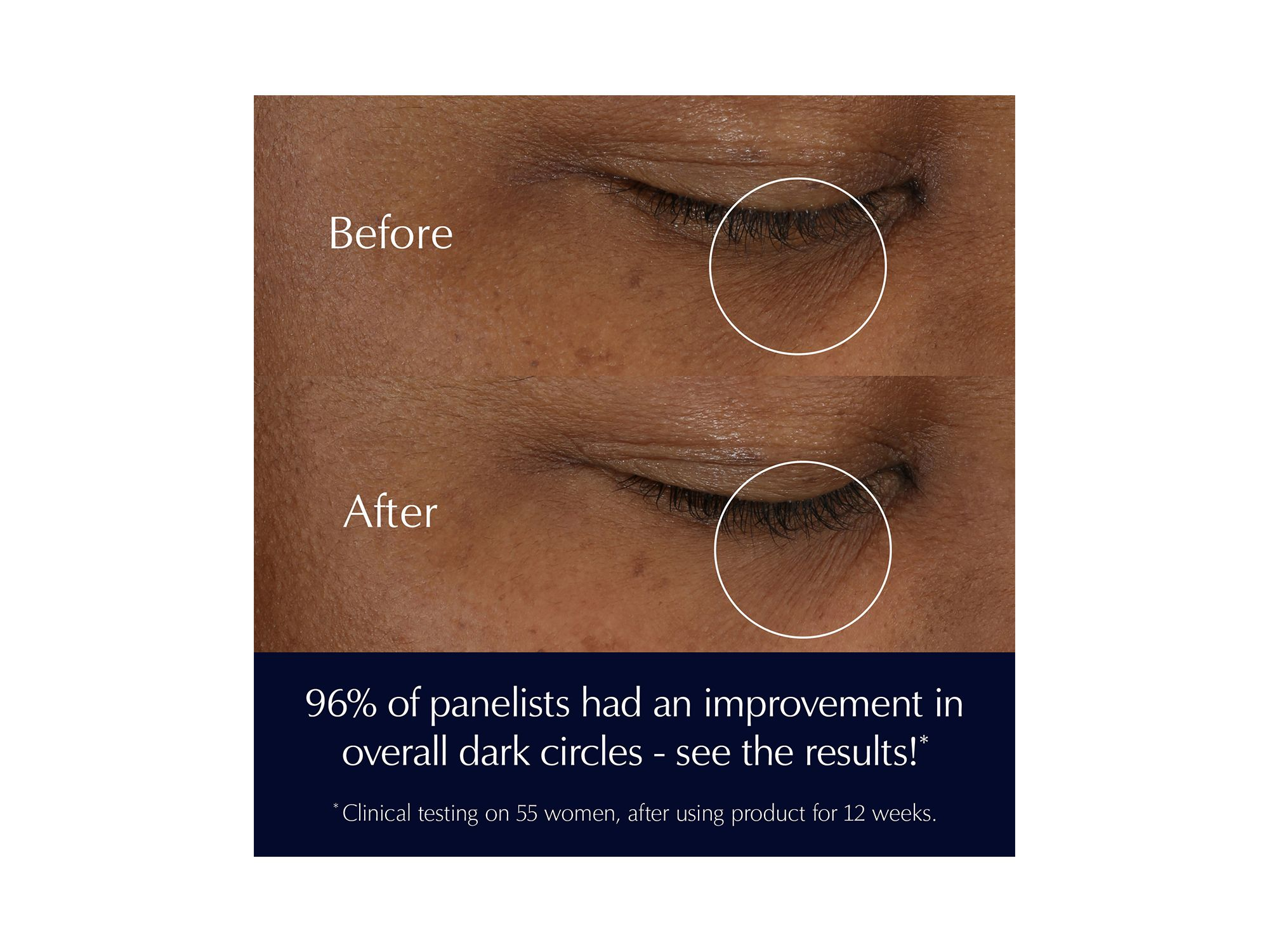 Advanced Night Repair Supercharged Eye Gel-Cream 0.5 oz. — Image 4