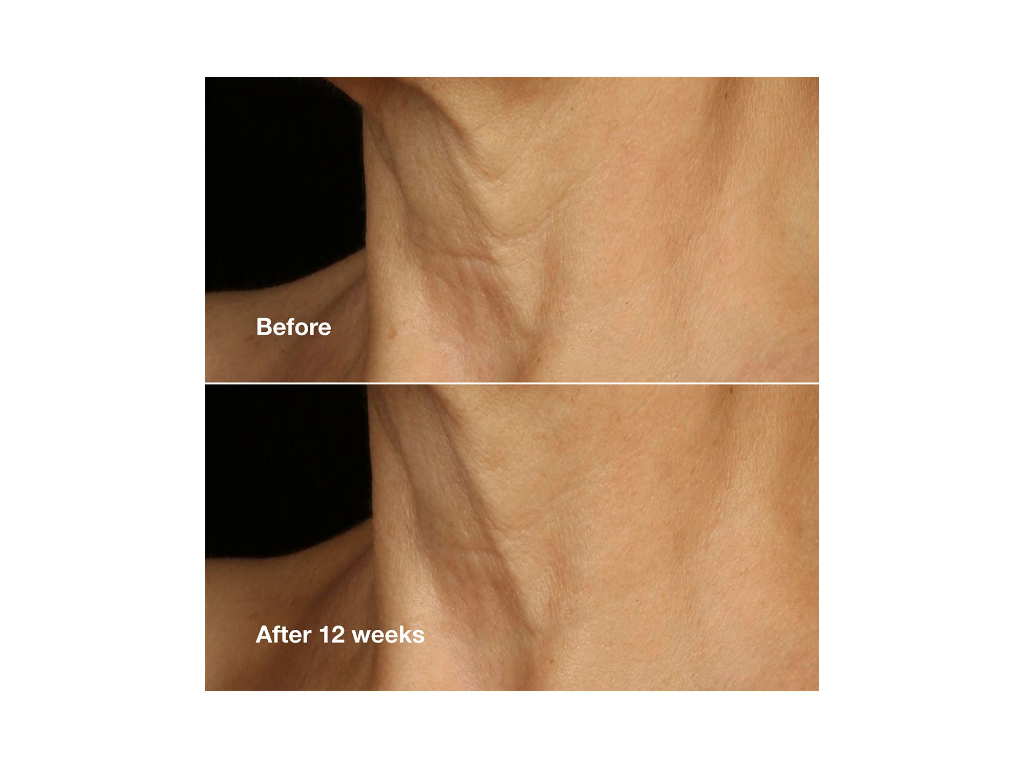 Smart Clinical Repair Lifting Face + Neck Cream — Image 5