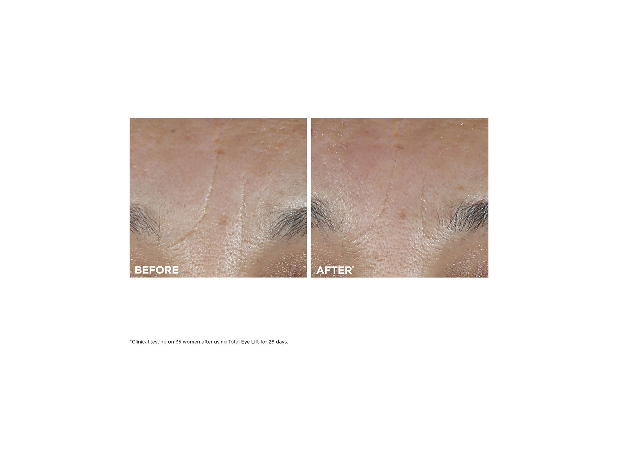 Total Eye Lift Eye Cream — Image 10