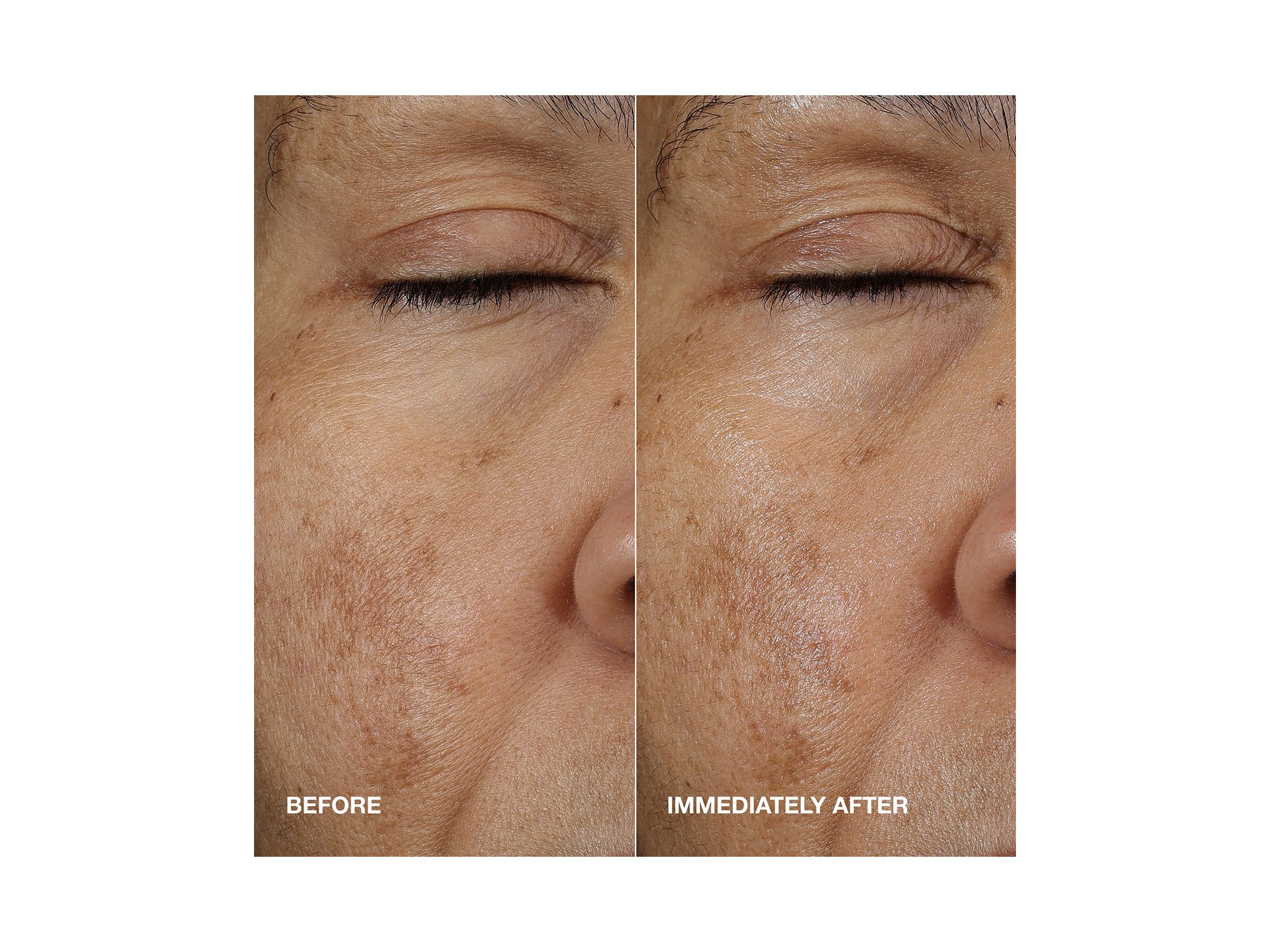 Moisture Surge Active Glow Serum with Hyaluronic Acid — Image 3