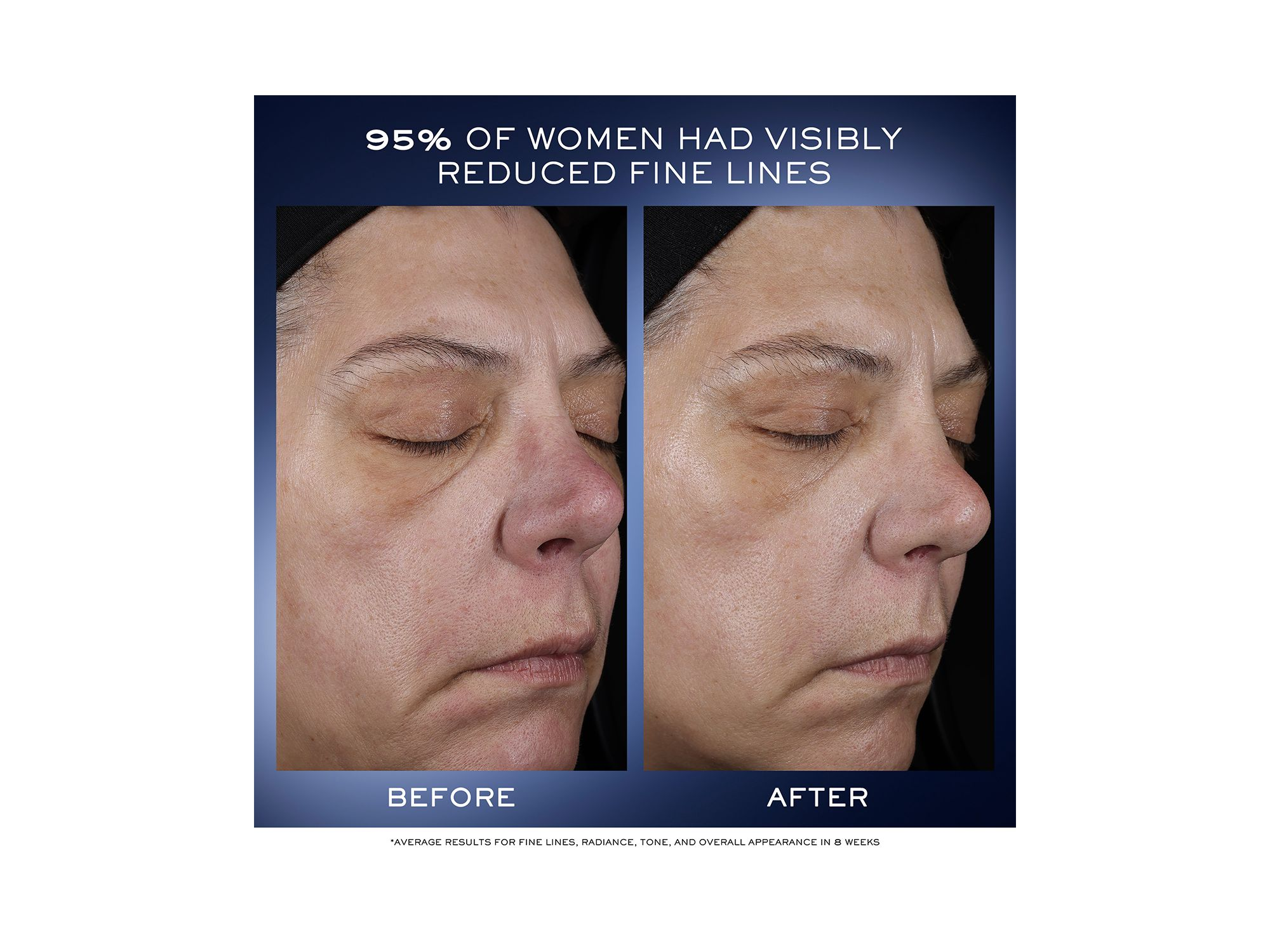 Génifique Ultimate Recovery Serum — Image 4