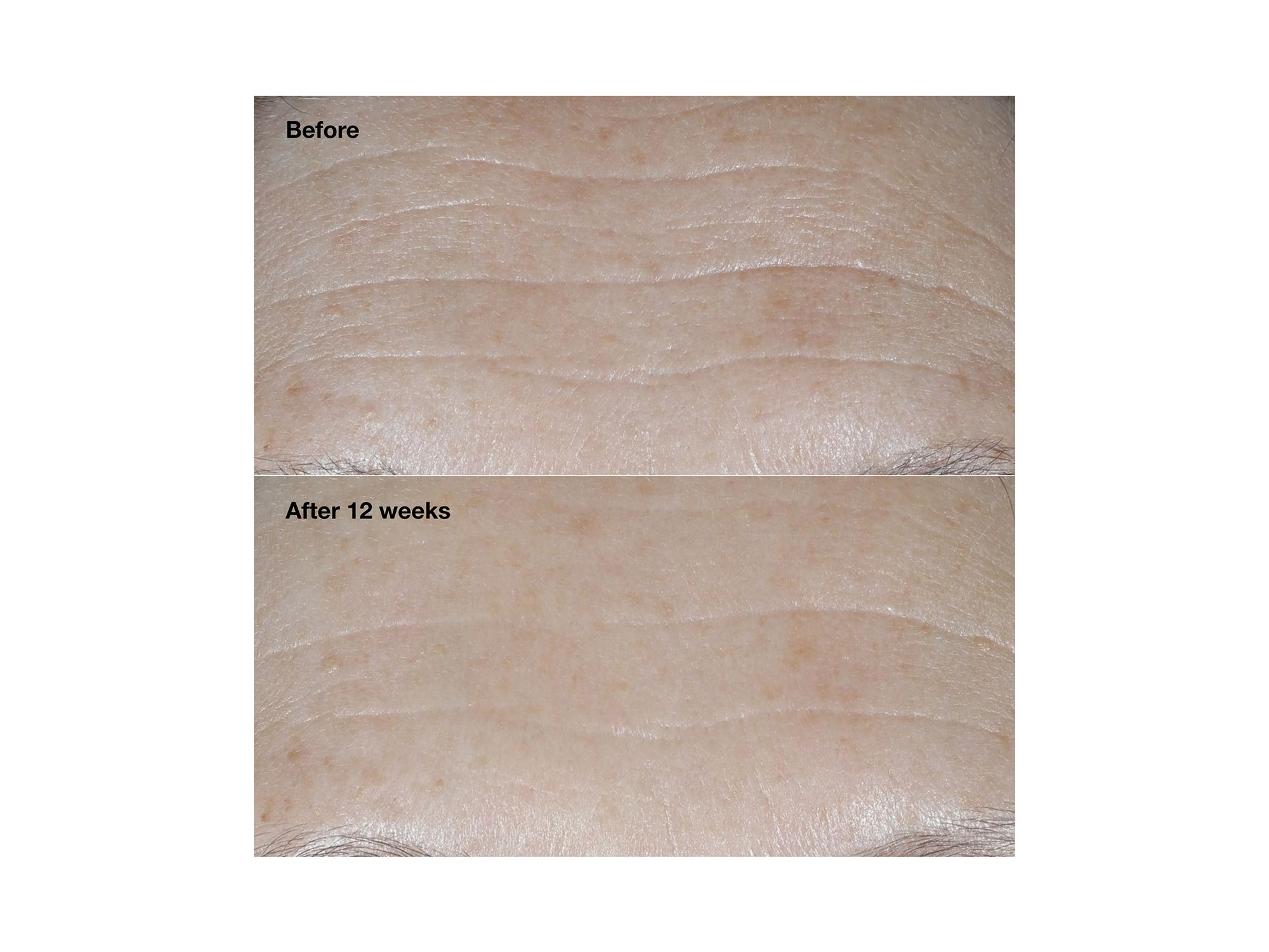 Smart Clinical Repair Broad Spectrum SPF 30 Wrinkle Correcting Face Cream — Image 3