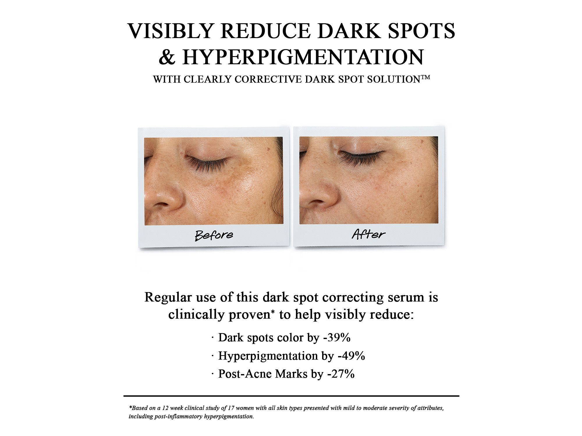 Clearly Corrective™ Dark Spot Solution — Image 6
