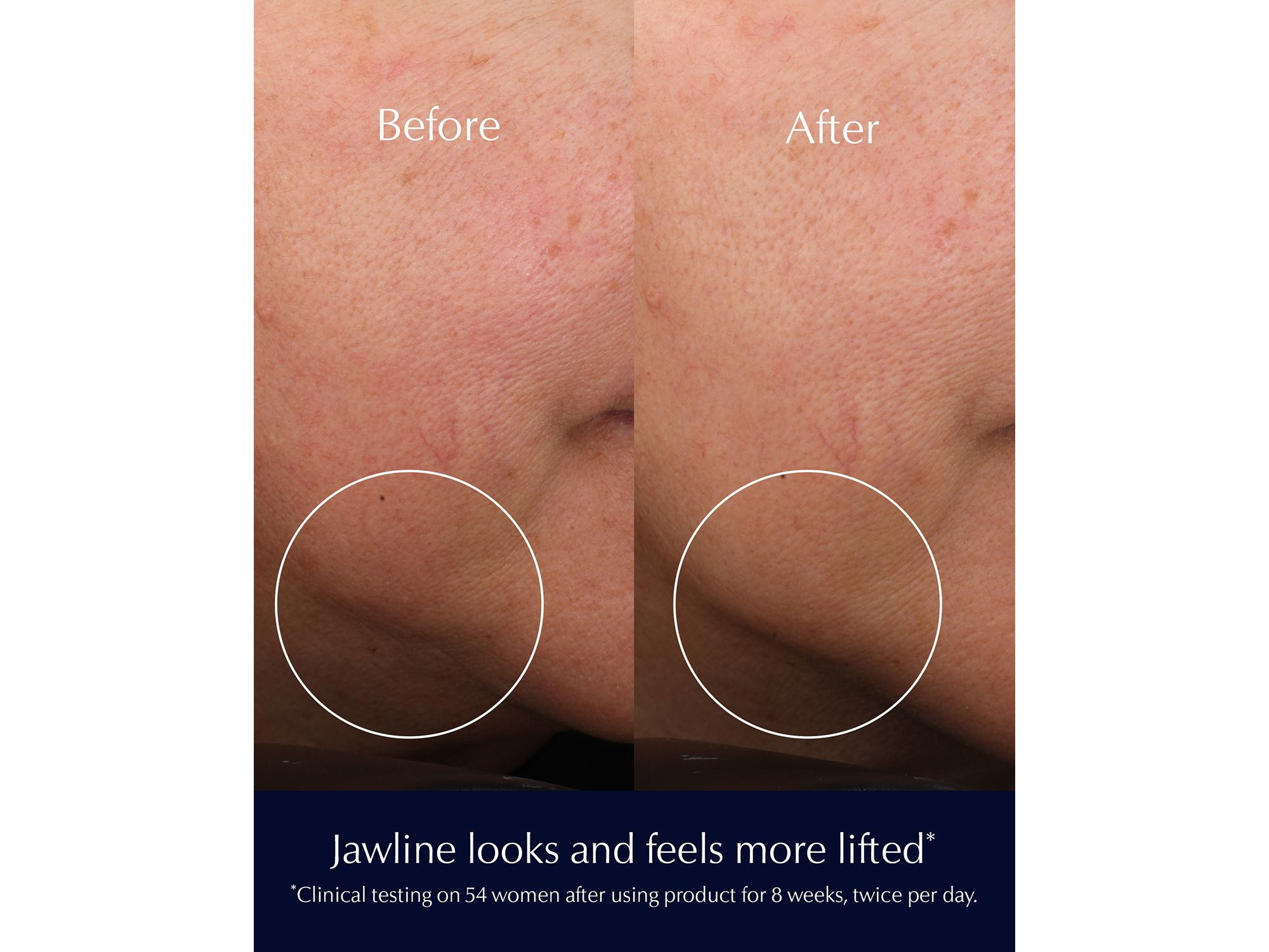 Nightly Renewal Skincare Set ($197 value) — Image 10