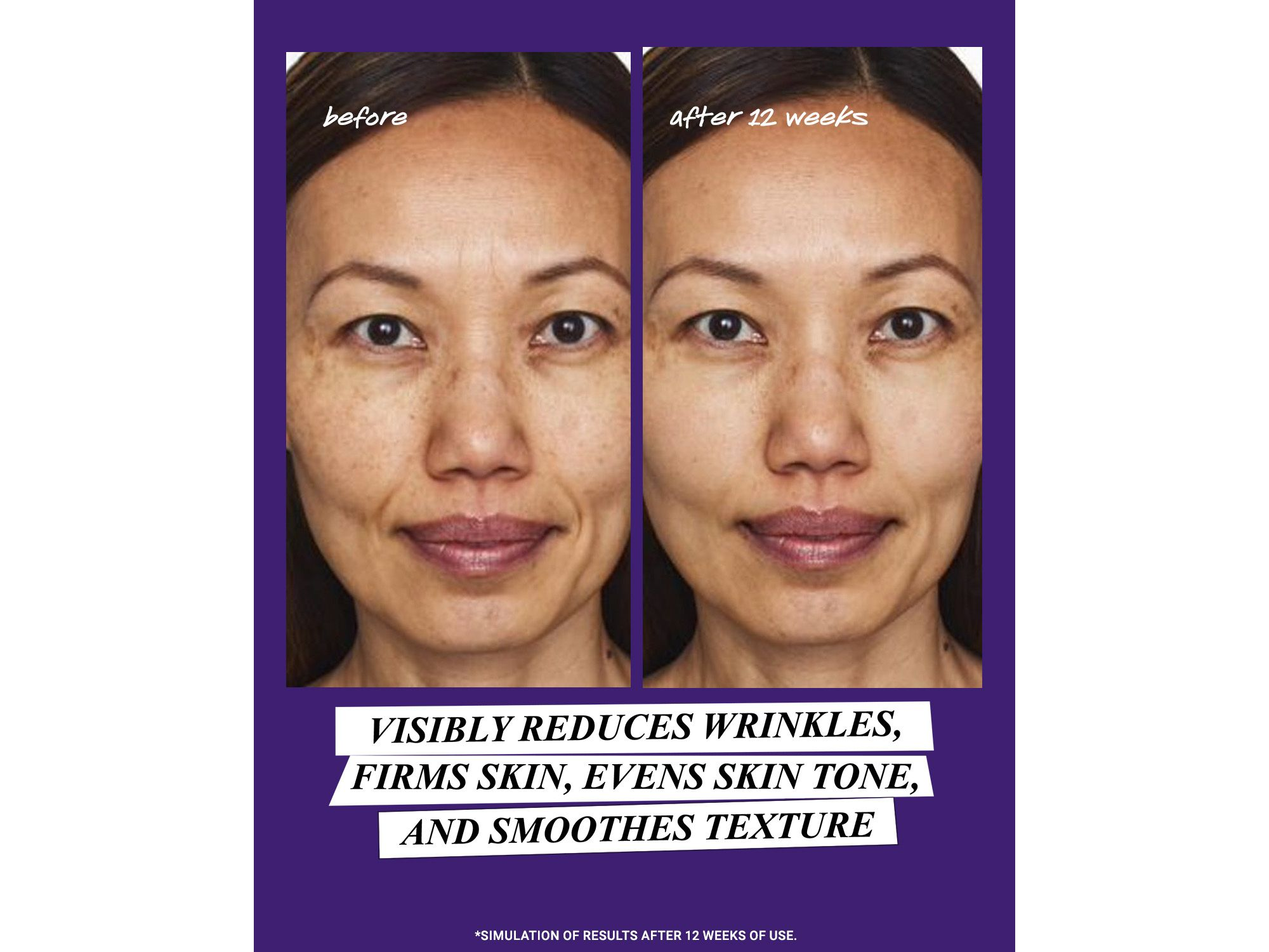 Retinol Skin-Renewing Daily Micro-Dose Serum — Image 8
