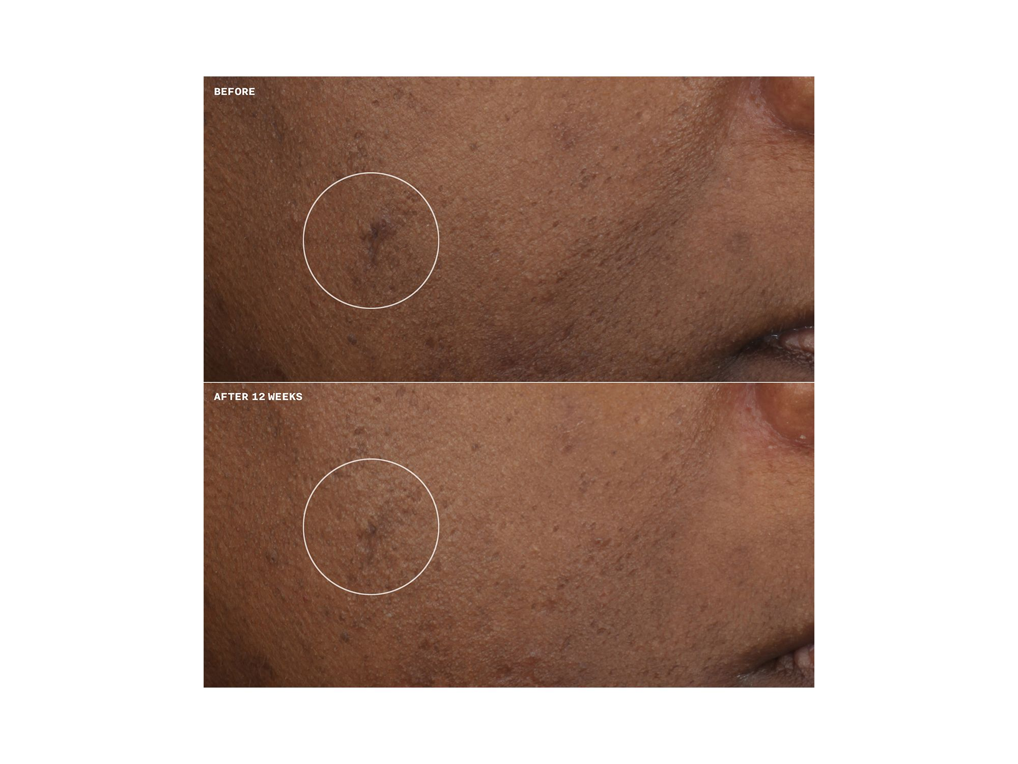 Even Better Clinical Brightening Moisturizer — Image 7