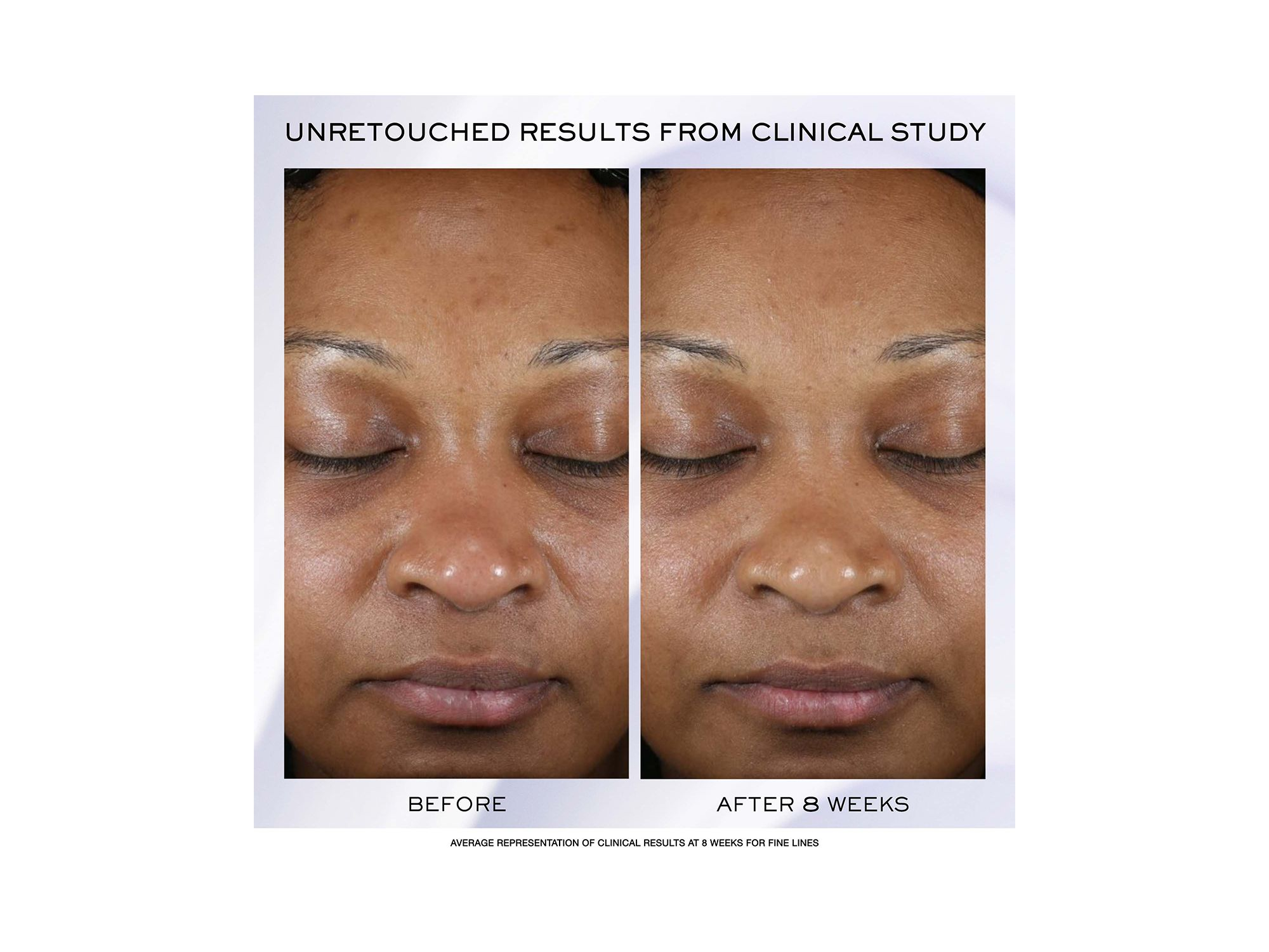 Rénergie H.P.N. 300-Peptide Anti-Aging Cream — Image 4