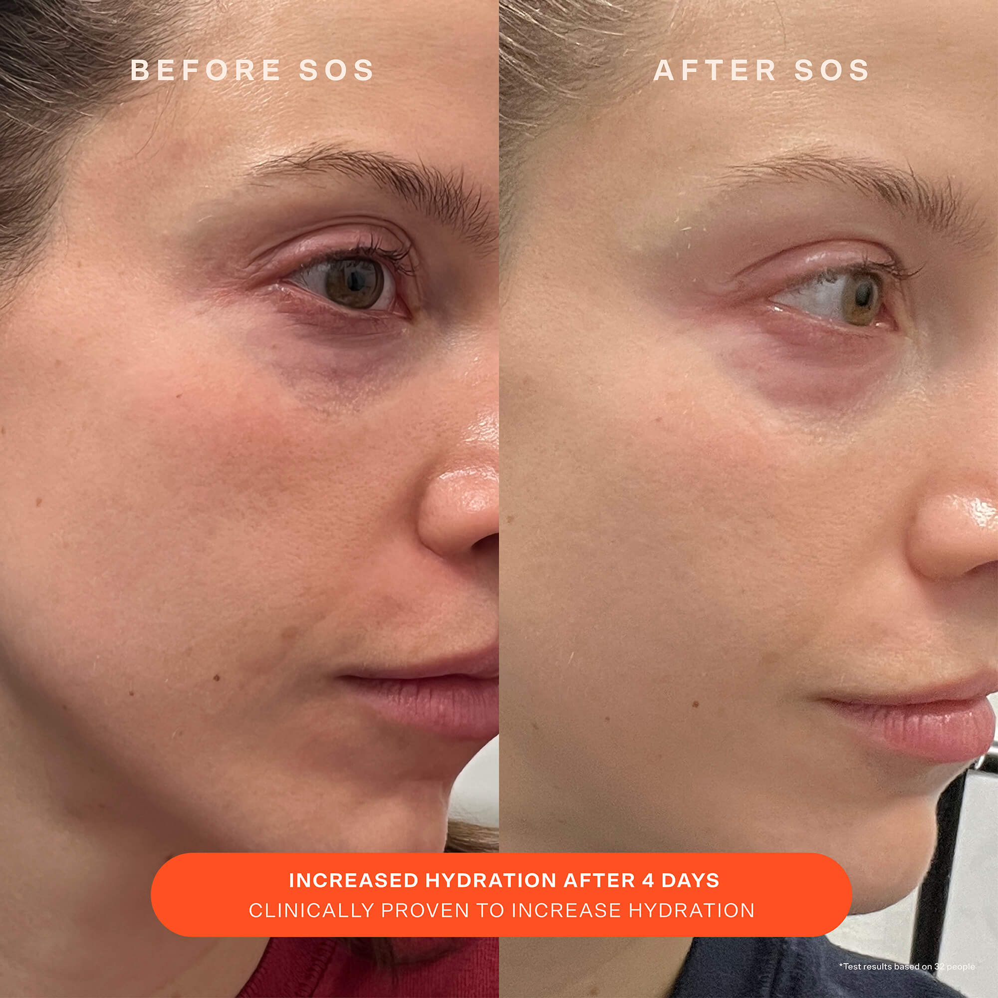 SOS Recovery Cream, image 4 of 11